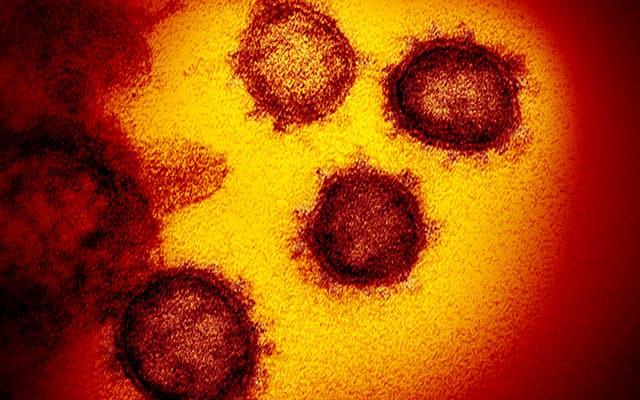 Para "construir" este virus, los científicos usaron la punta de la corona de la variante ómicron y la incorporaron al "esqueleto" de la versión ancestral, la detectada en Wuhan / National Institute of Allergy and Infectious Diseases