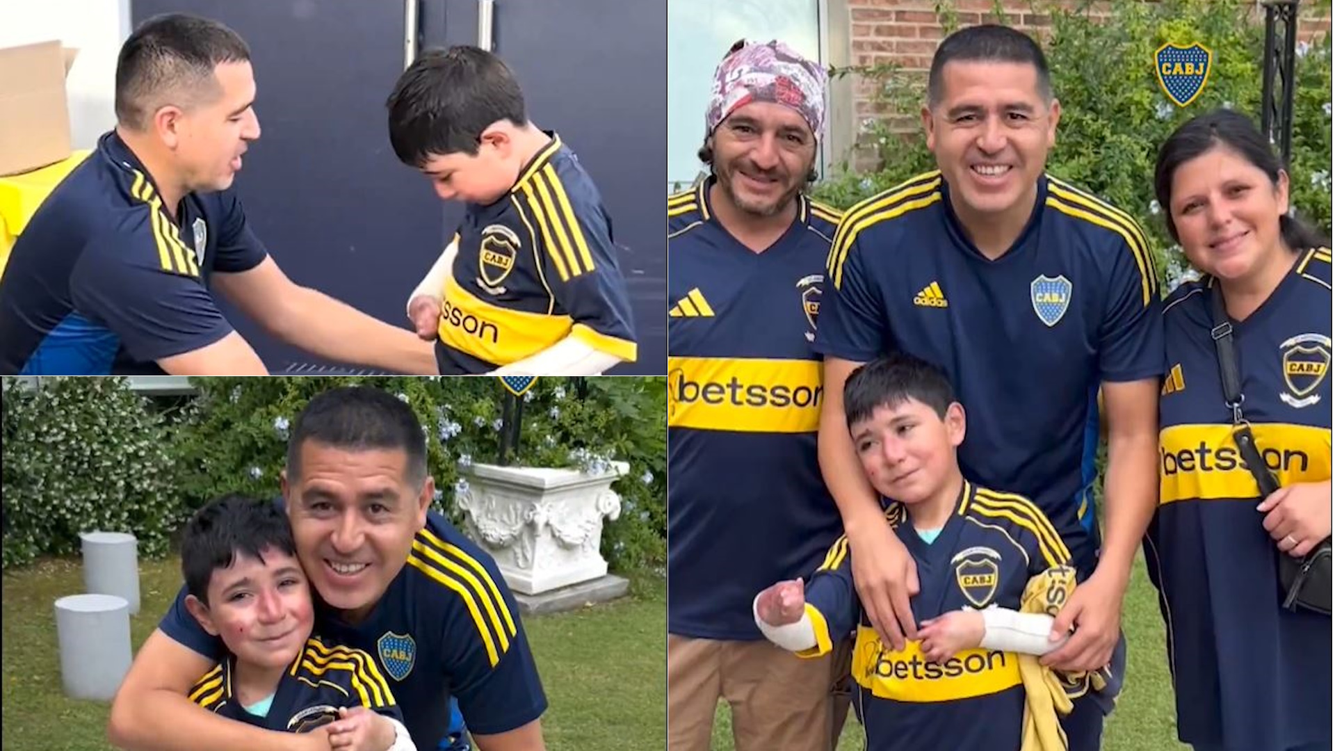 La historia detrás del gesto de Riquelme con un niño que padece una enfermedad en la piel: “Verlo jugar a Román le calmaba el dolor”