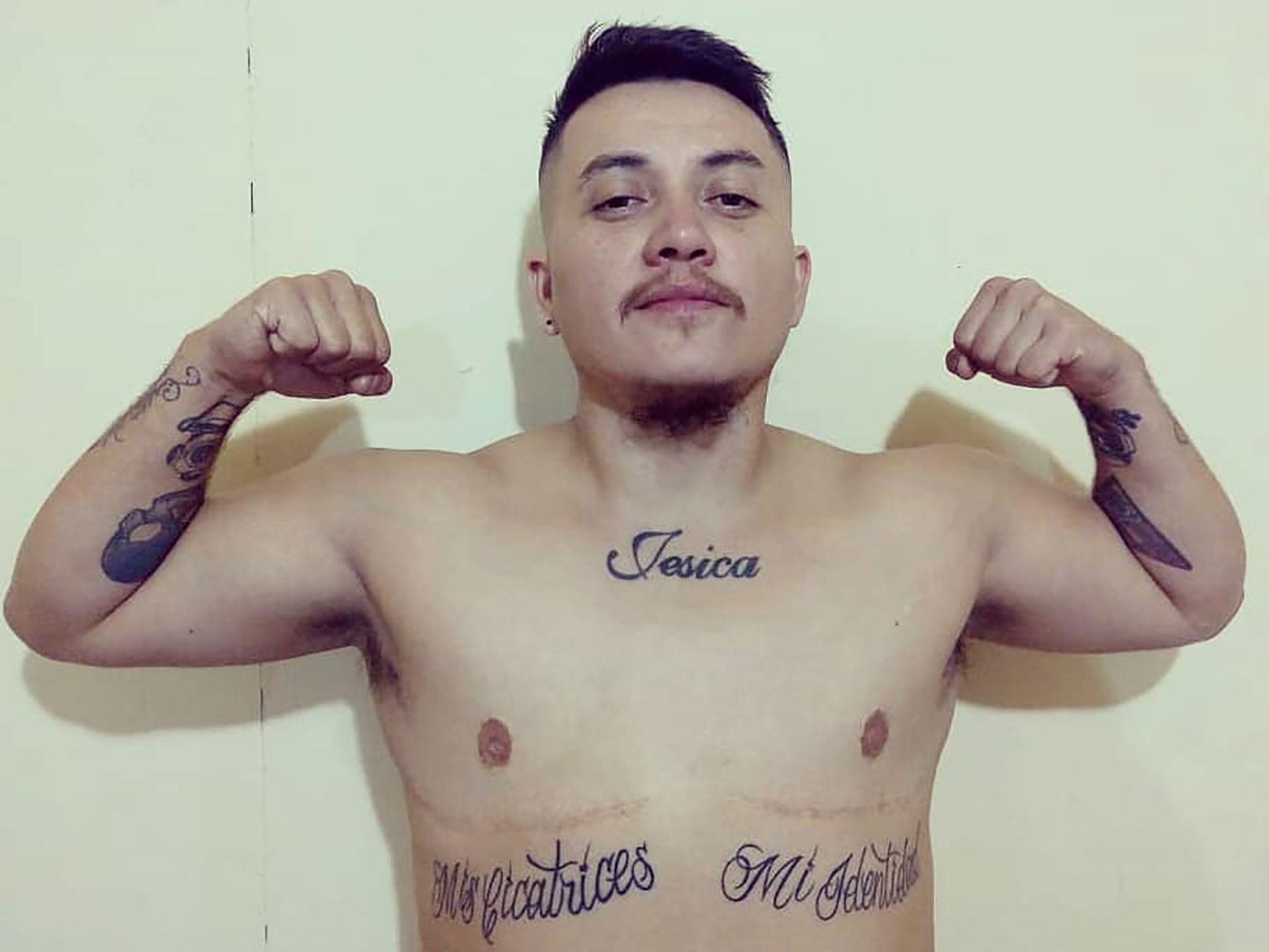 "Mis cicatrices, mi identidad" dice el tatuaje debajo de las marcas de la mastectomía