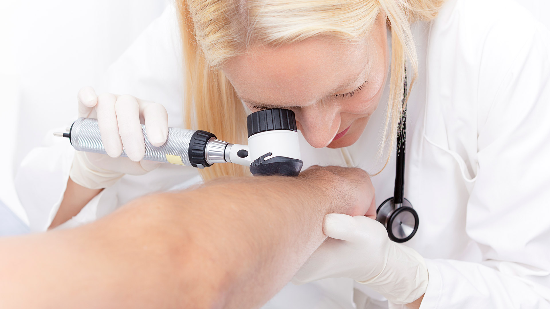Es importante el chequeo periódico de los lunares de la piel para la detección precoz del melanoma (Foto: Getty)