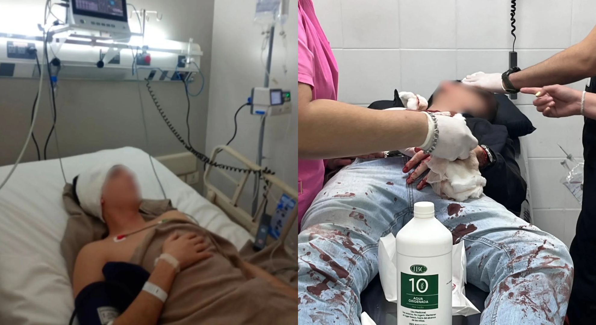 Denunciaron una brutal golpiza por homofobia contra una pareja en Tucumán: uno de ellos está en terapia intensiva