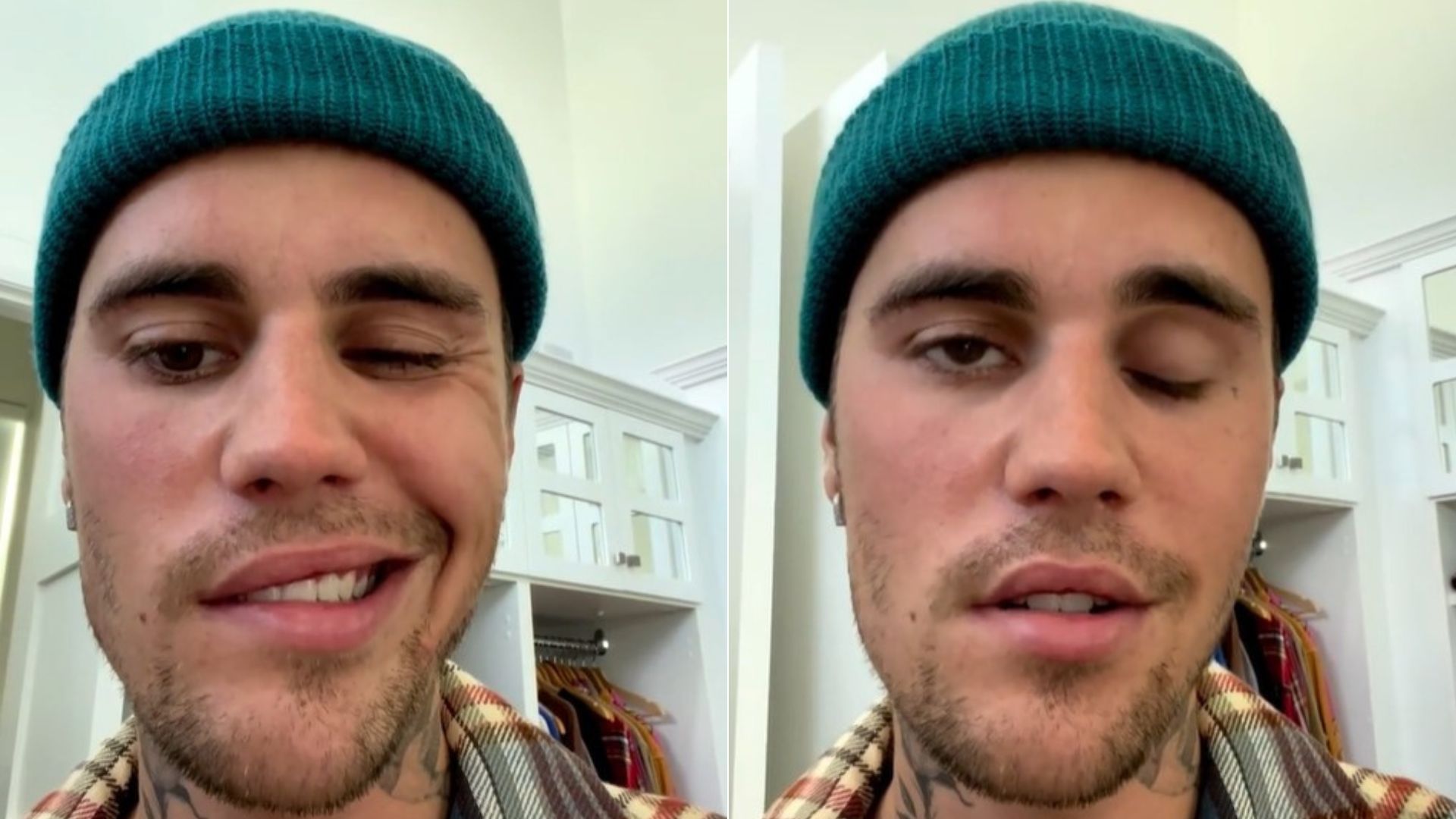 En junio, Justin Bieber mostró en un video la parálisis que afectaba su párpado (Foto: captura de pantalla/Instagram)