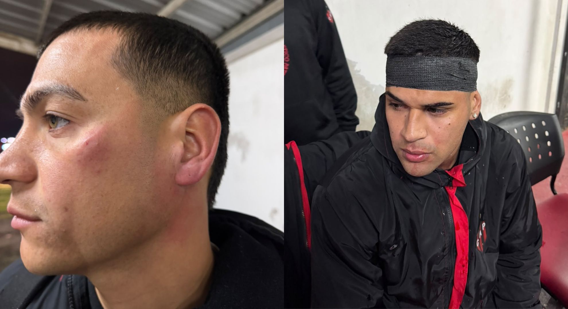 Un grupo de hinchas de Patronato agredi&oacute; a los jugadores luego de la derrota ante Col&oacute;n