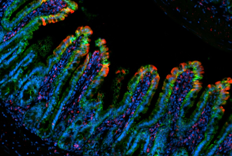 El intestino delgado, a diferencia de grueso, tiene relativamente pocas bacterias debido al rápido flujo de su contenido y a la presencia de bilis / CREDIT: Image courtesy of Dr. Lei Zhou