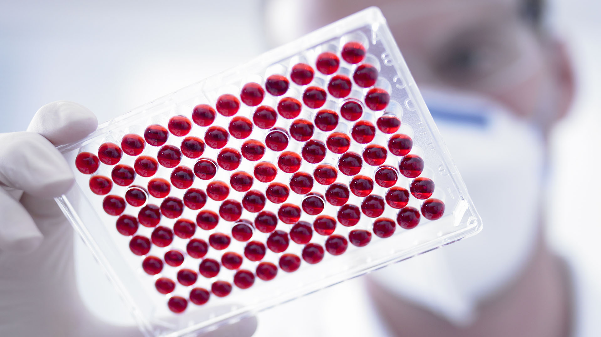 Un test de sangre durante la infección podría predecir la probabilidad de COVID prolongado