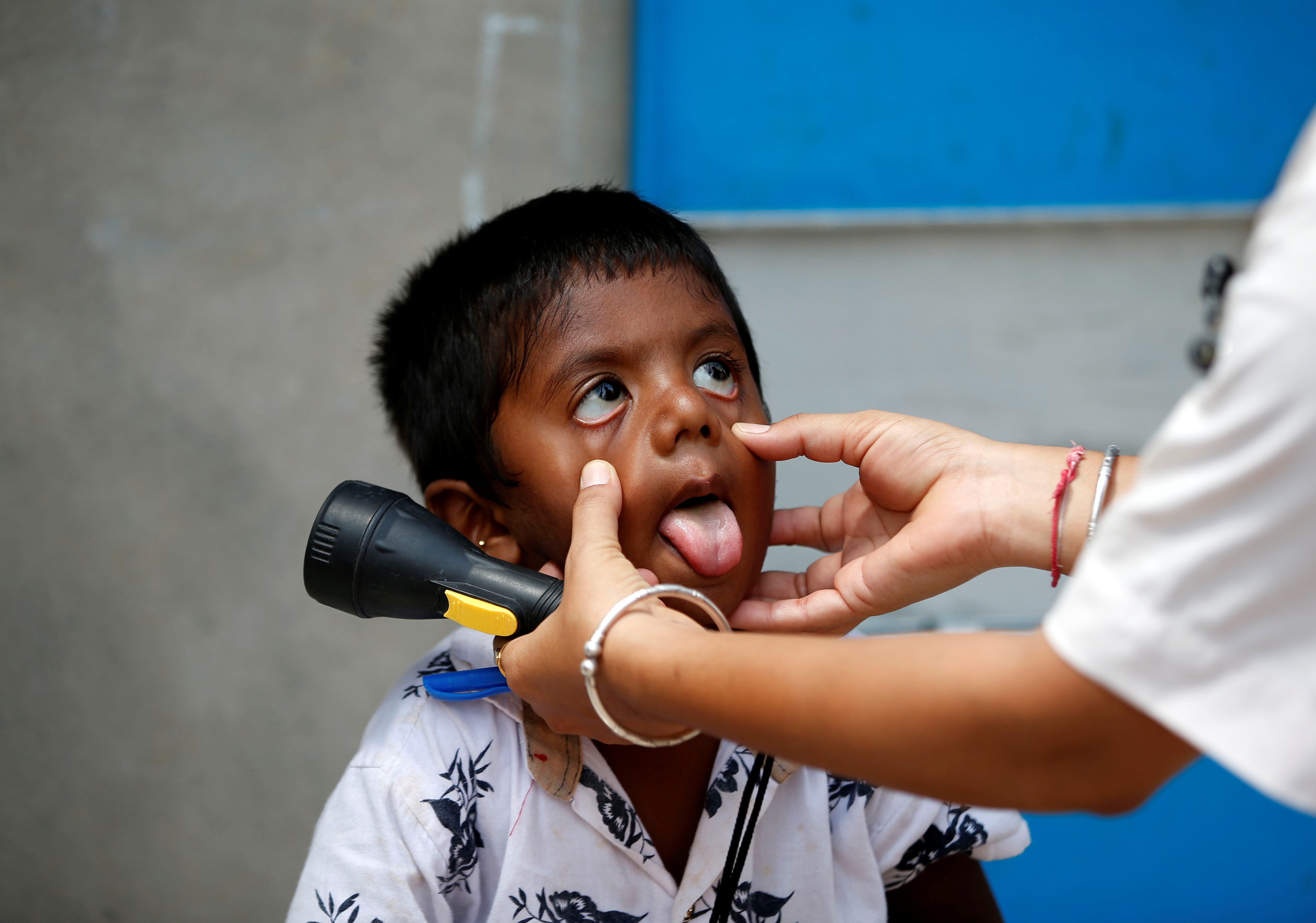 Imagen de referencia de un niño siendo revisado por un médico (Foto: REUTERS/Amit Dave)