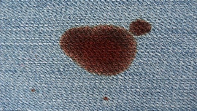 Cómo quitar las manchas sangre de la ropa, métodos 100% probados y efectivos - Infobae