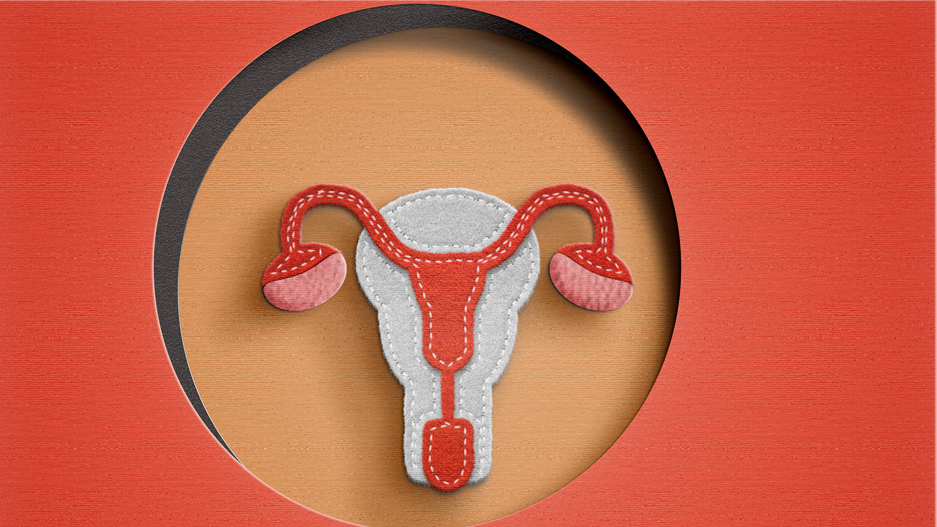 Las mujeres con síndrome de ovario poliquístico son “una bomba de tiempo” frente al COVID-19 y otras enfermedades, advierten los especialistas (Foto: Getty)