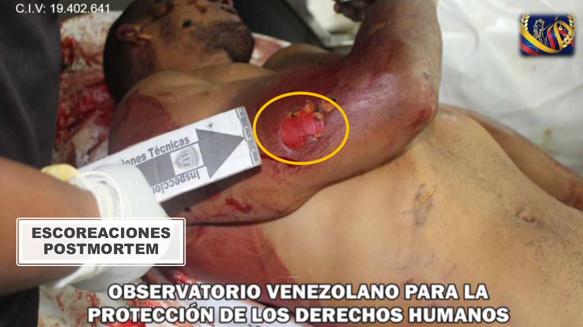 Masacre de Macuto - Operación Gedeón