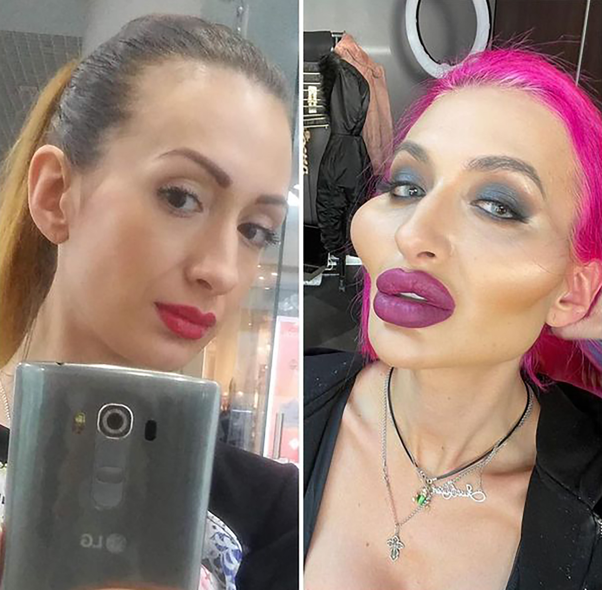 El antes y el después de Pokreshchuk (IG: @_just__queen_)