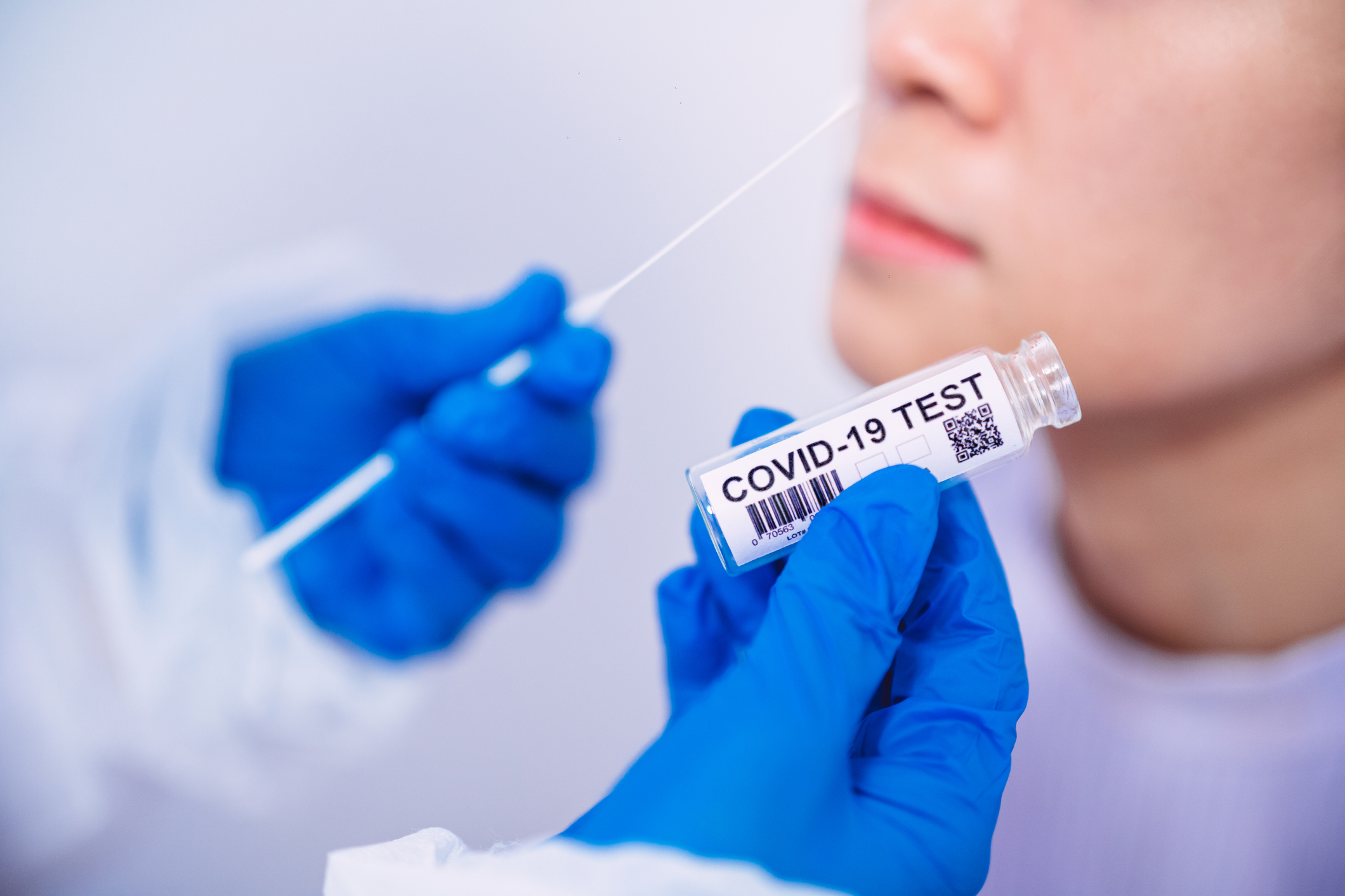 Para conocer el avance de los sublinajes es necesario que los expertos cuenten con muestras para realizar PCR / (Getty Images)