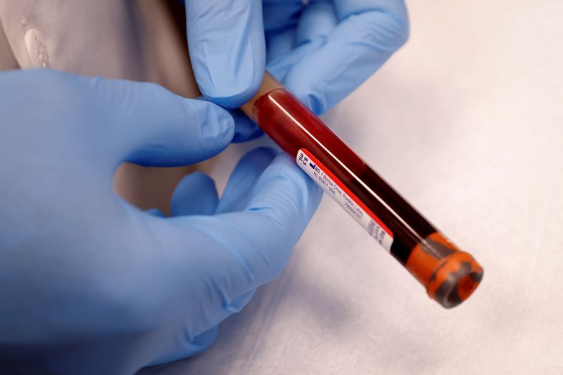 Foto ilustrativa del jueves de un vial de sangre tras un estudio de anticuerpos al coronavirus en Nueva York. 
 REUTERS/Mike Segar