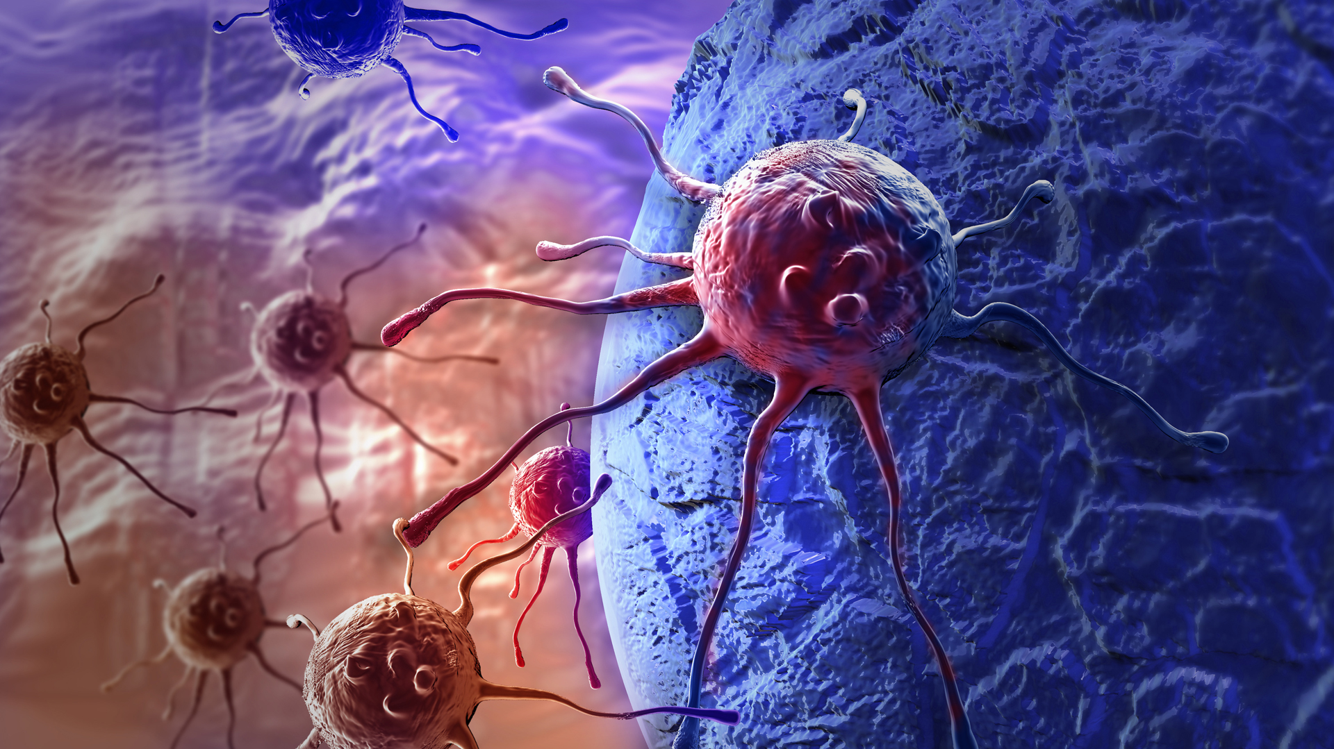Cáncer de colon: identificaron las células tumorales responsables de la recaída y la metástasis 