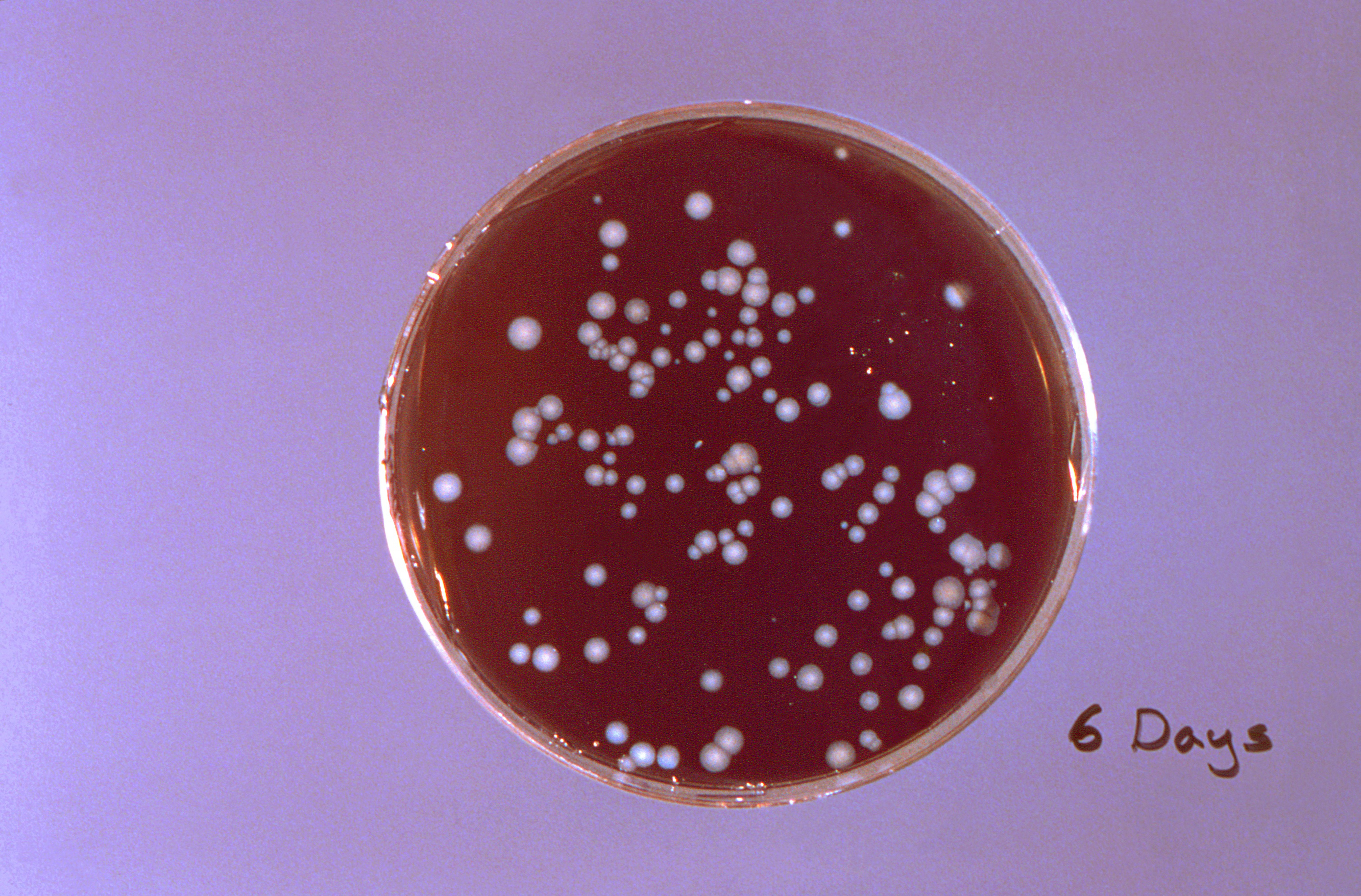 Las nuevas bacterias y virus pueden generar graves enfermedades (Photo by Smith Collection/Gado/Getty Images).