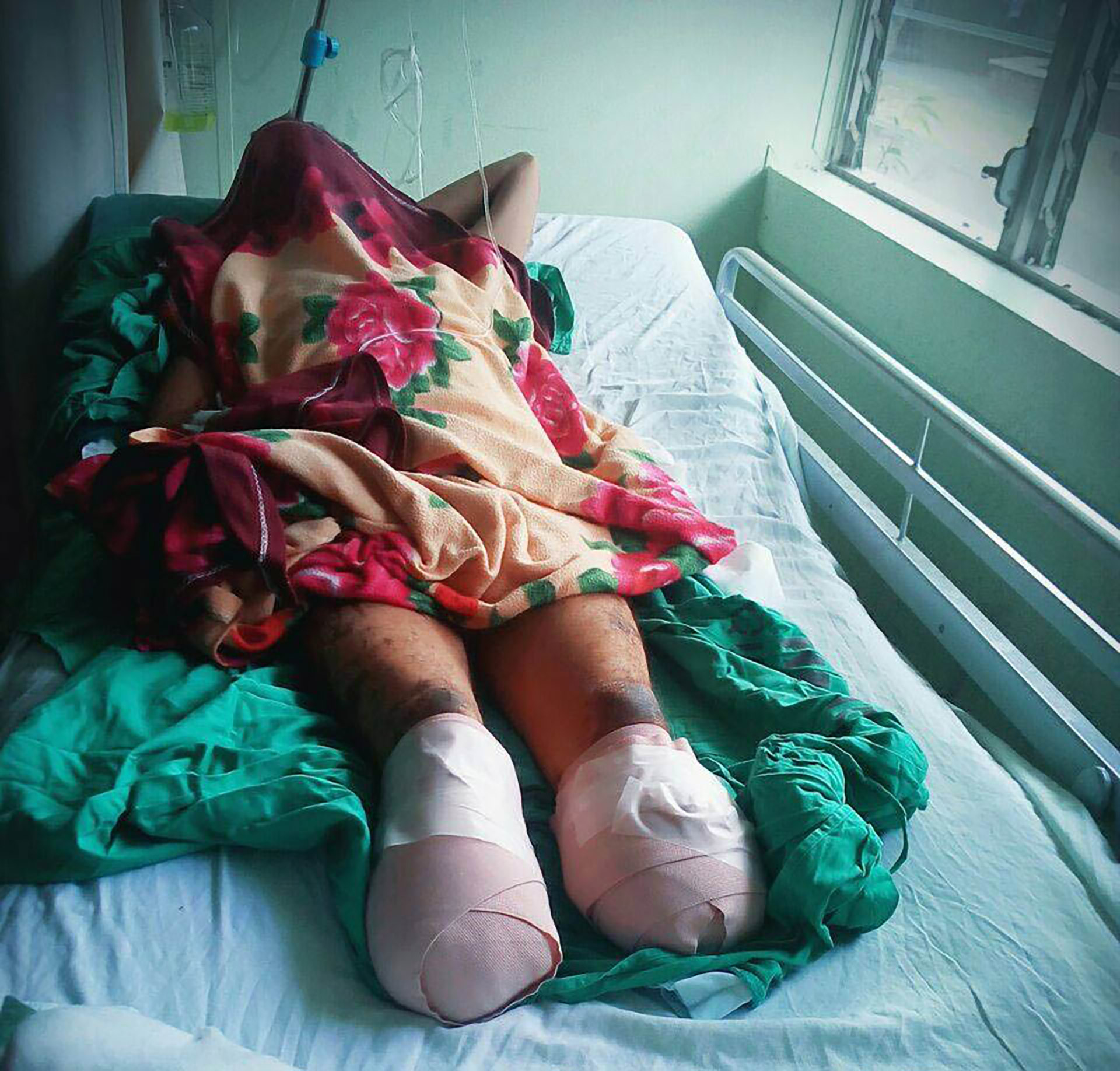 El campesino Juan Lanzas perdió sus pies en enero de 2018 después que sufrió una golpiza al ser detenido, fue recluido en un baño inmundo durante 18 días lo que le provocó gangrena, (Foto cortesía La Prensa)