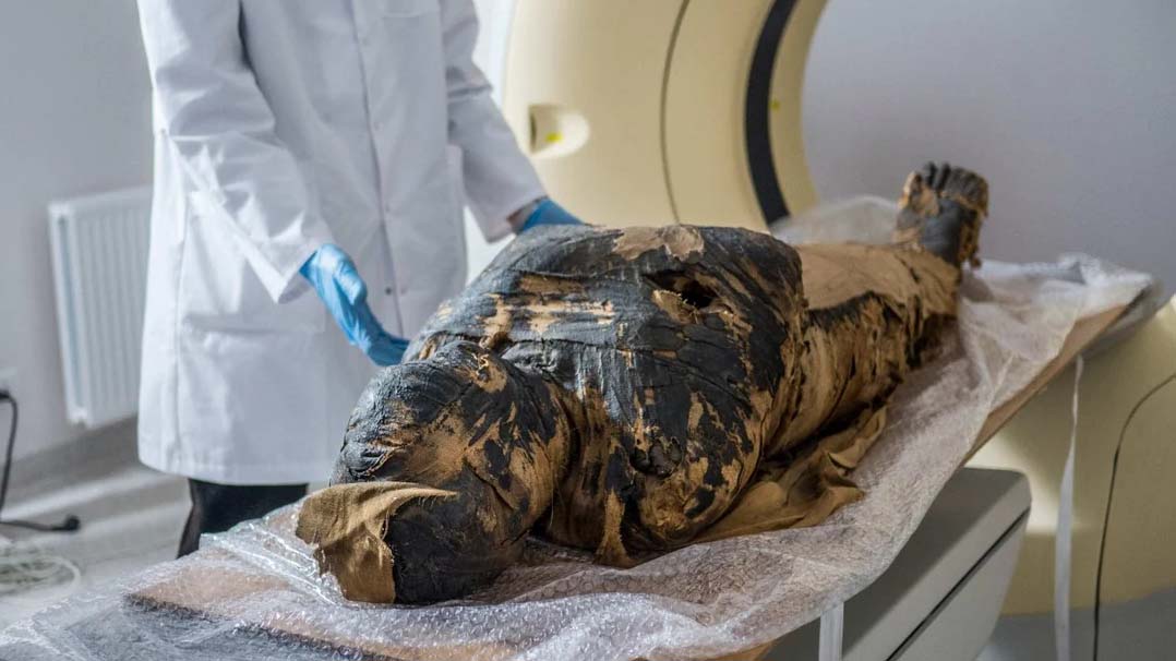 Imagen de archivo de la primera momia egipcia embarazada del mundo descubierta en Polonia (AFP)