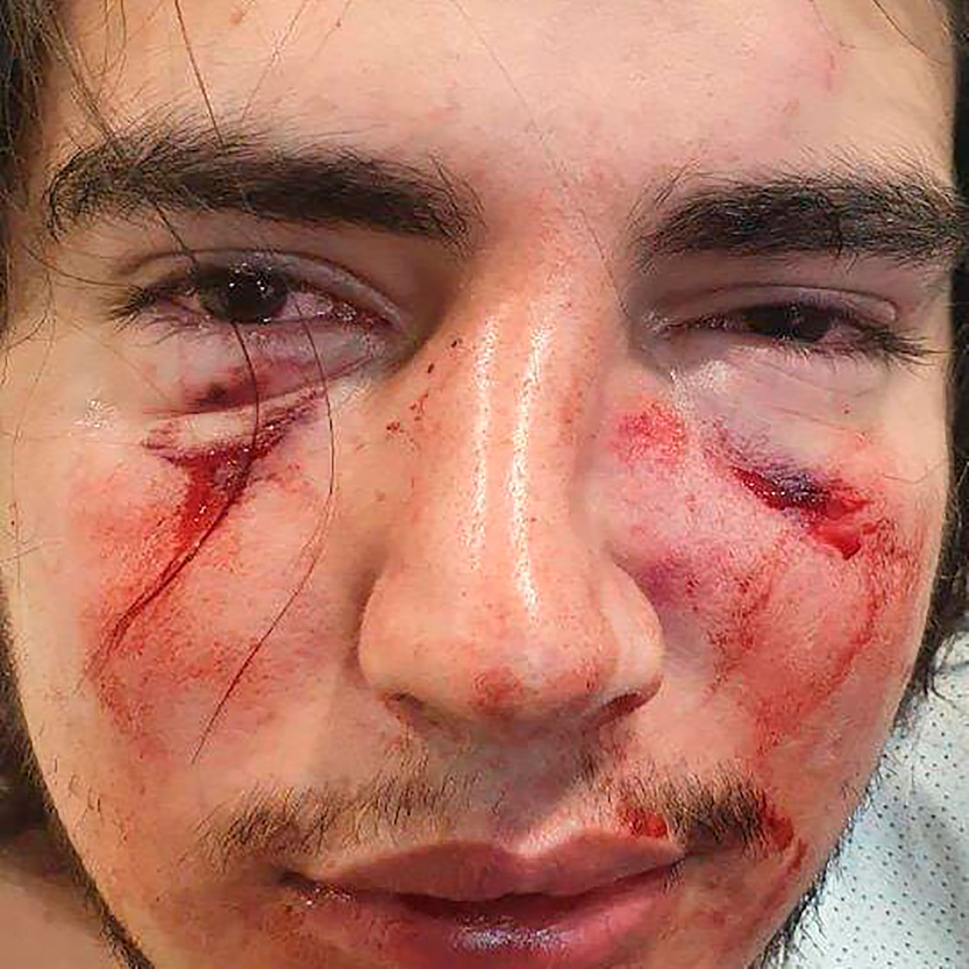 La foto de Lautaro Insúa tras la brutal golpiza