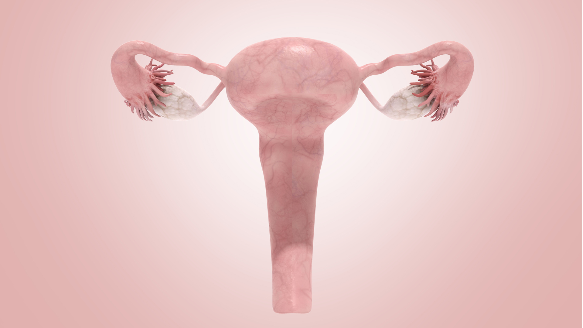 La histerectomía es la cirugía en la cual se extirpa el útero, puede ser realizada mediante cirugía laparoscópica, cirugía convencional o cirugía vaginal (Getty Images)
