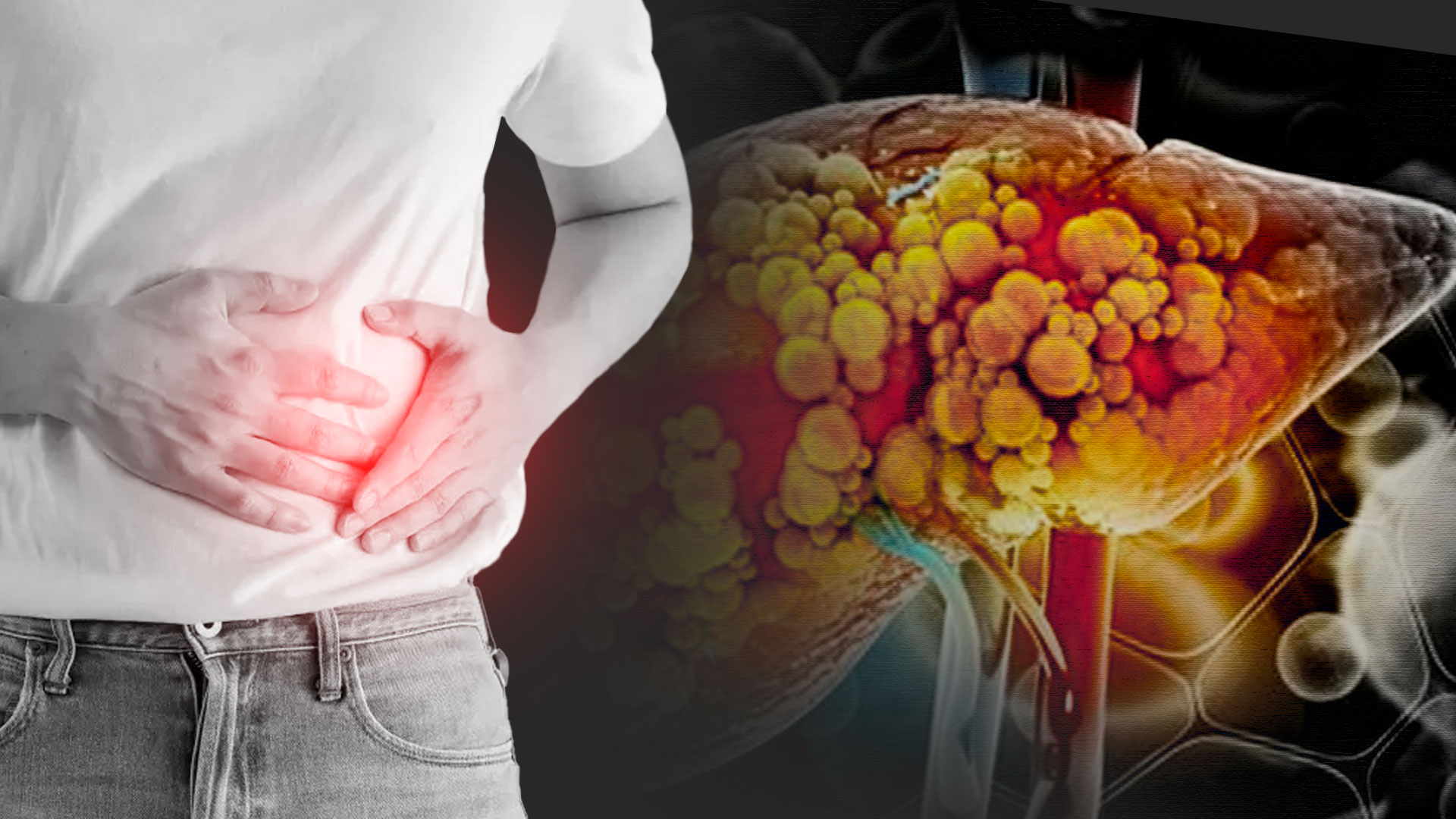 Toronjil: esta es la planta medicinal que mejora la salud del hígado graso  y ayuda a prevenir la cirrosis hepática - Infobae