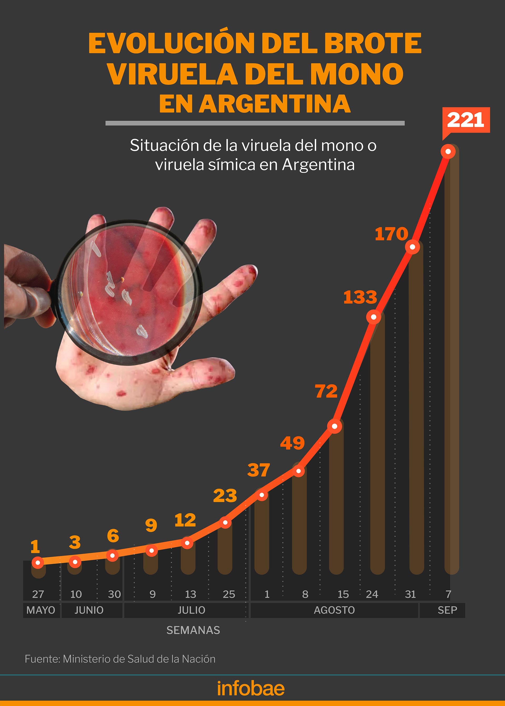 Los casos de viruela símica aumentaron a mayor ritmo desde agosto en Argentina (Infografía: Marcelo Regalado)