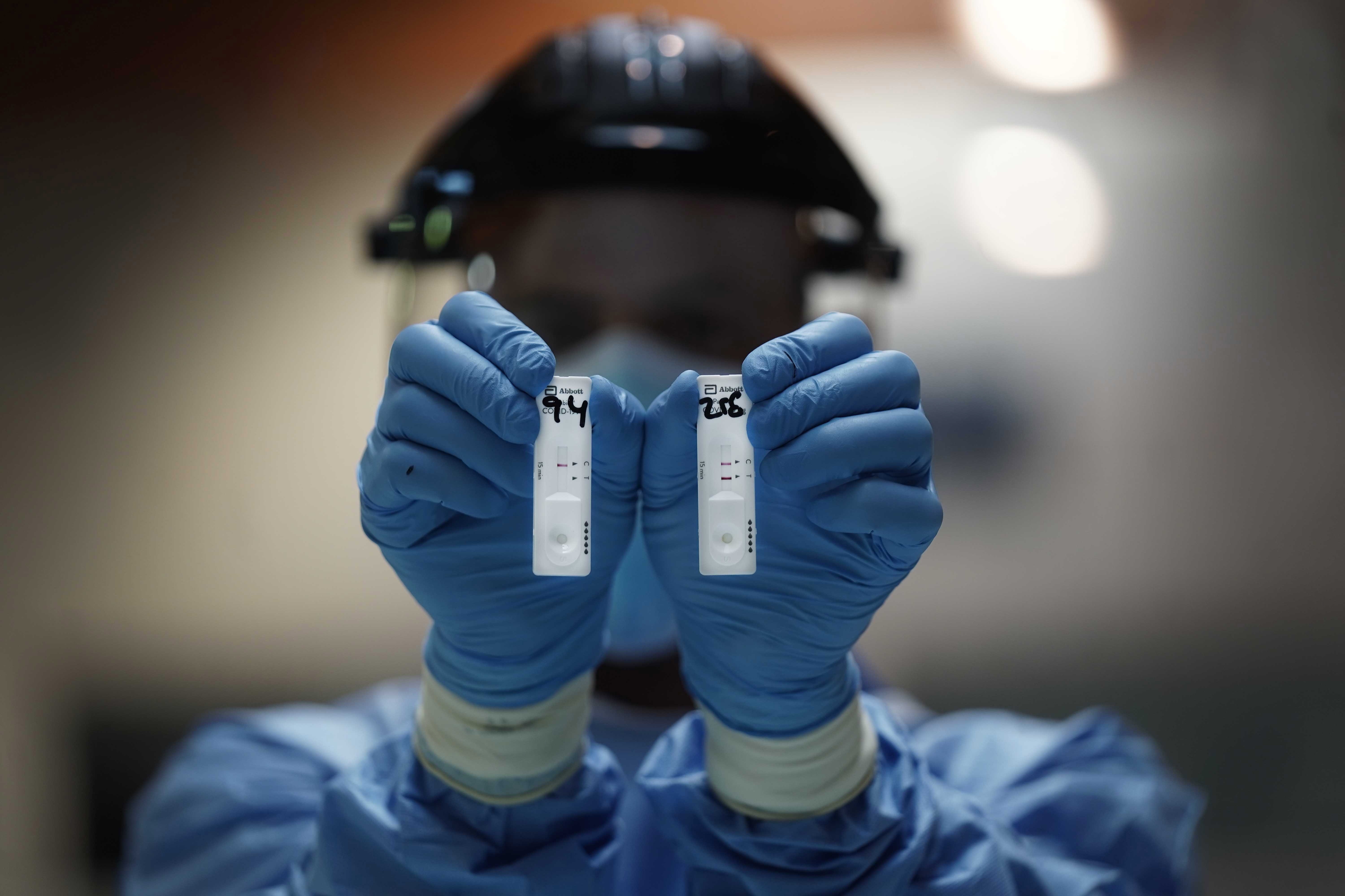El Ministerio de Salud de la Provincia presentó los resultados de los estudios sobre las variantes del virus SARS-CoV-2, que se realizan desde el inicio de la pandemia (EFE)