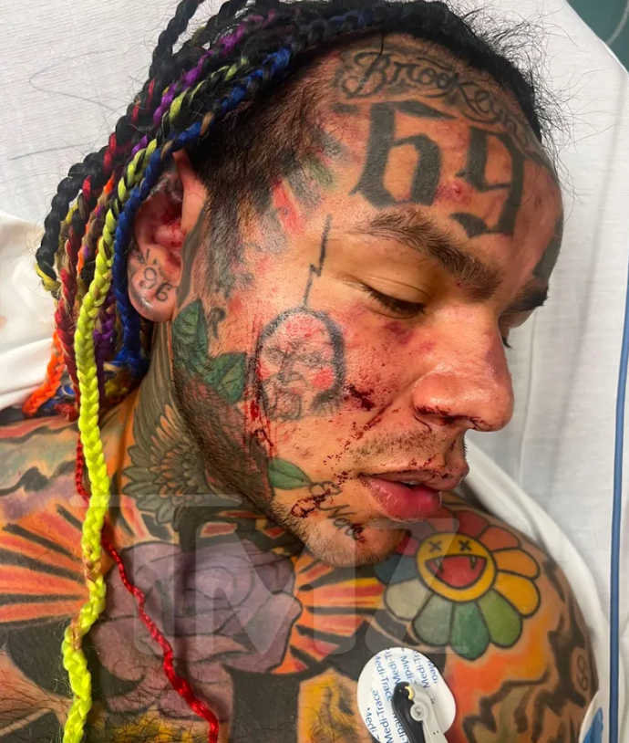 El rapero Tekashi 6ix9ine fue hospitalizado de emergencia tras recibir una brutal golpiza en un gimnasio de Florida. (Crédito: TMZ)