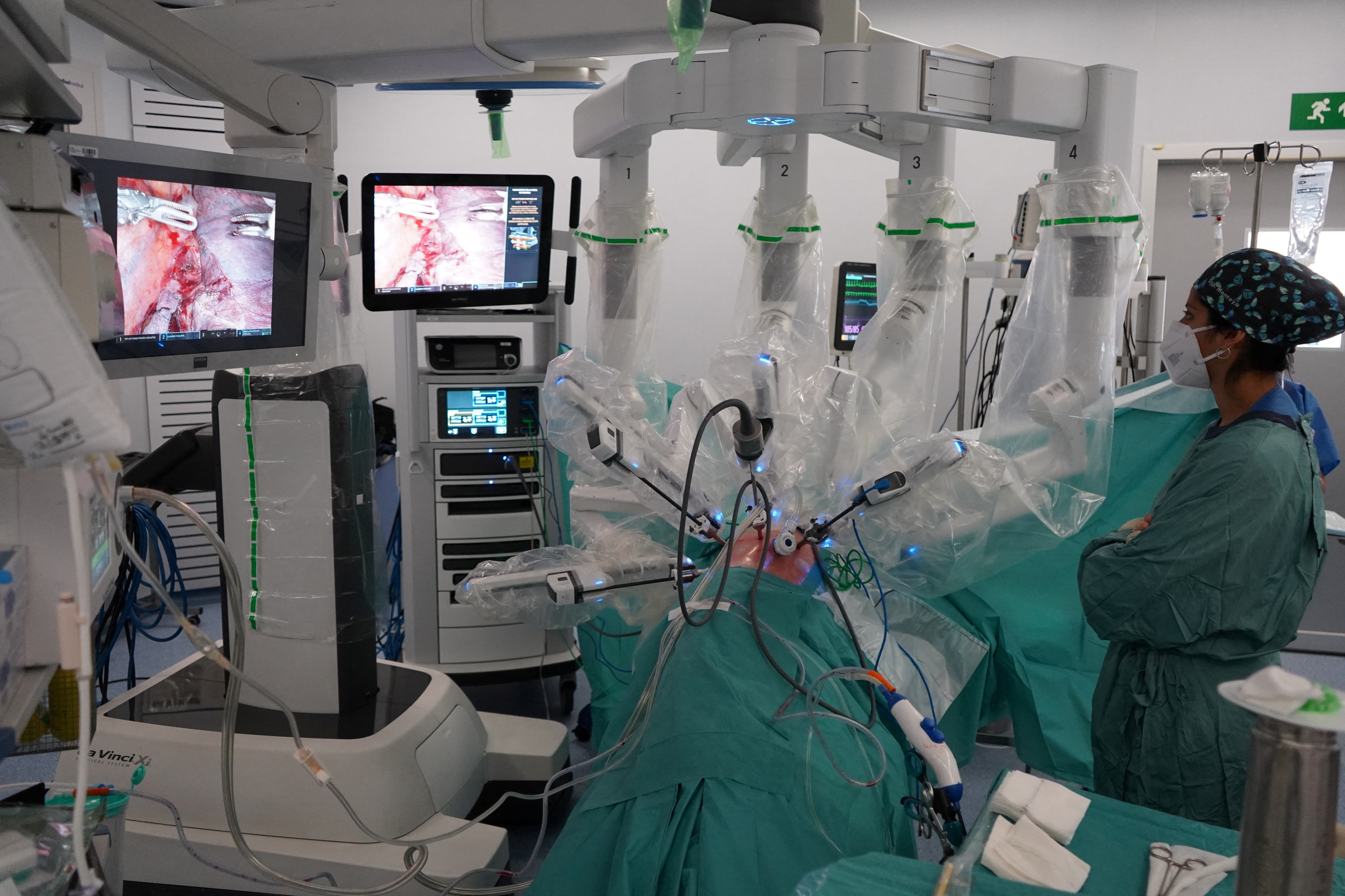 Uno de los últimas experiencias exitosas fue la que llevaron a cabo profesionales españoles del  Hospital Vall d’Hebron de Barcelona que llevó a cabo el primer trasplante pulmonar con cirugía completamente robótica a través de una nueva vía (REUTERS)