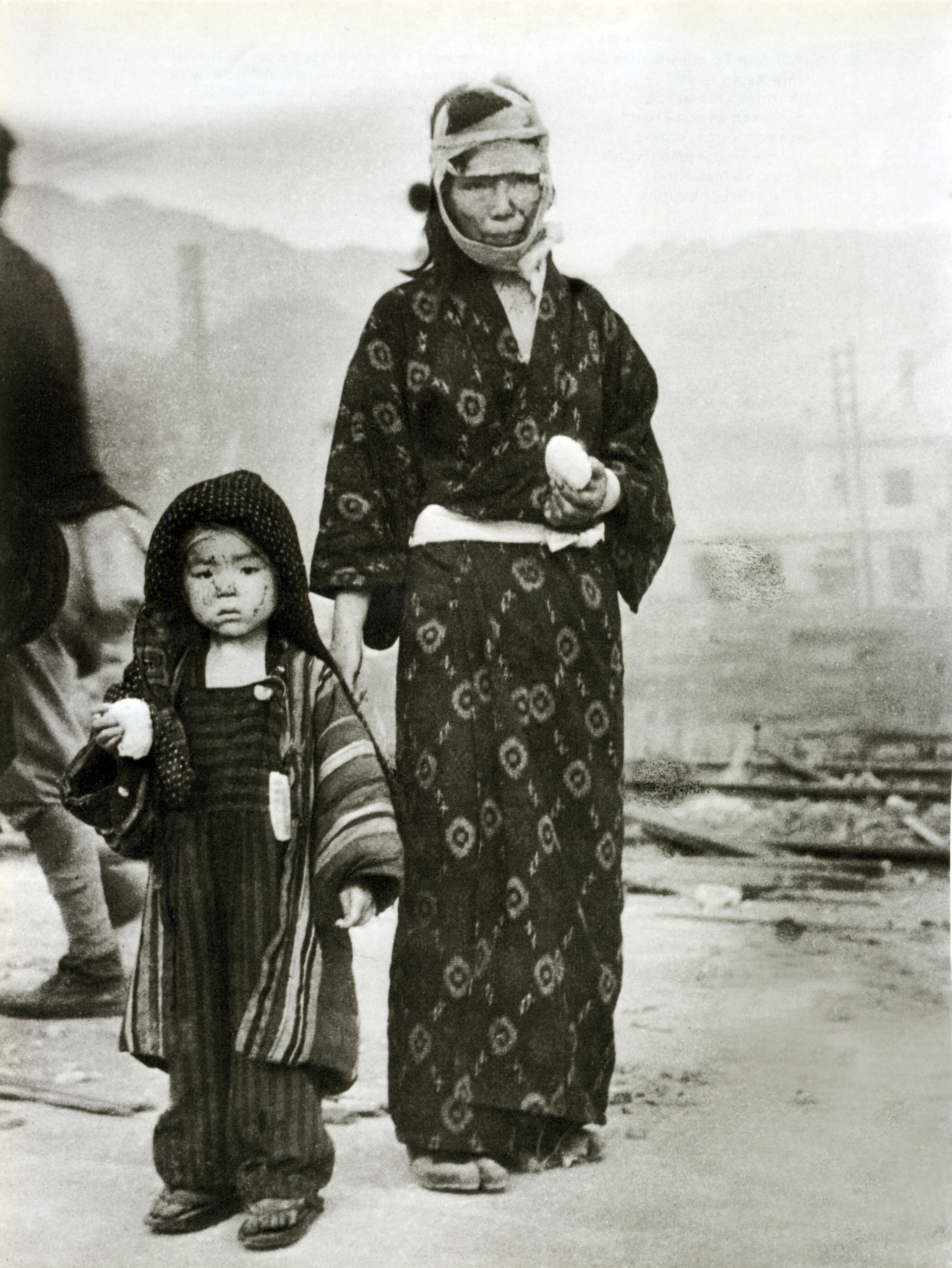 Una niña con su madre en Nagasaki la mañana siguiente al lanzamiento de la bomba atómica, el 10 de agosto de 1945. Su casa fue destruida, están a 1,5 km al sureste núcleo de la explosión y les han dado una bola de arroz como alimento (Galerie Bilderwelt/Getty Images)
