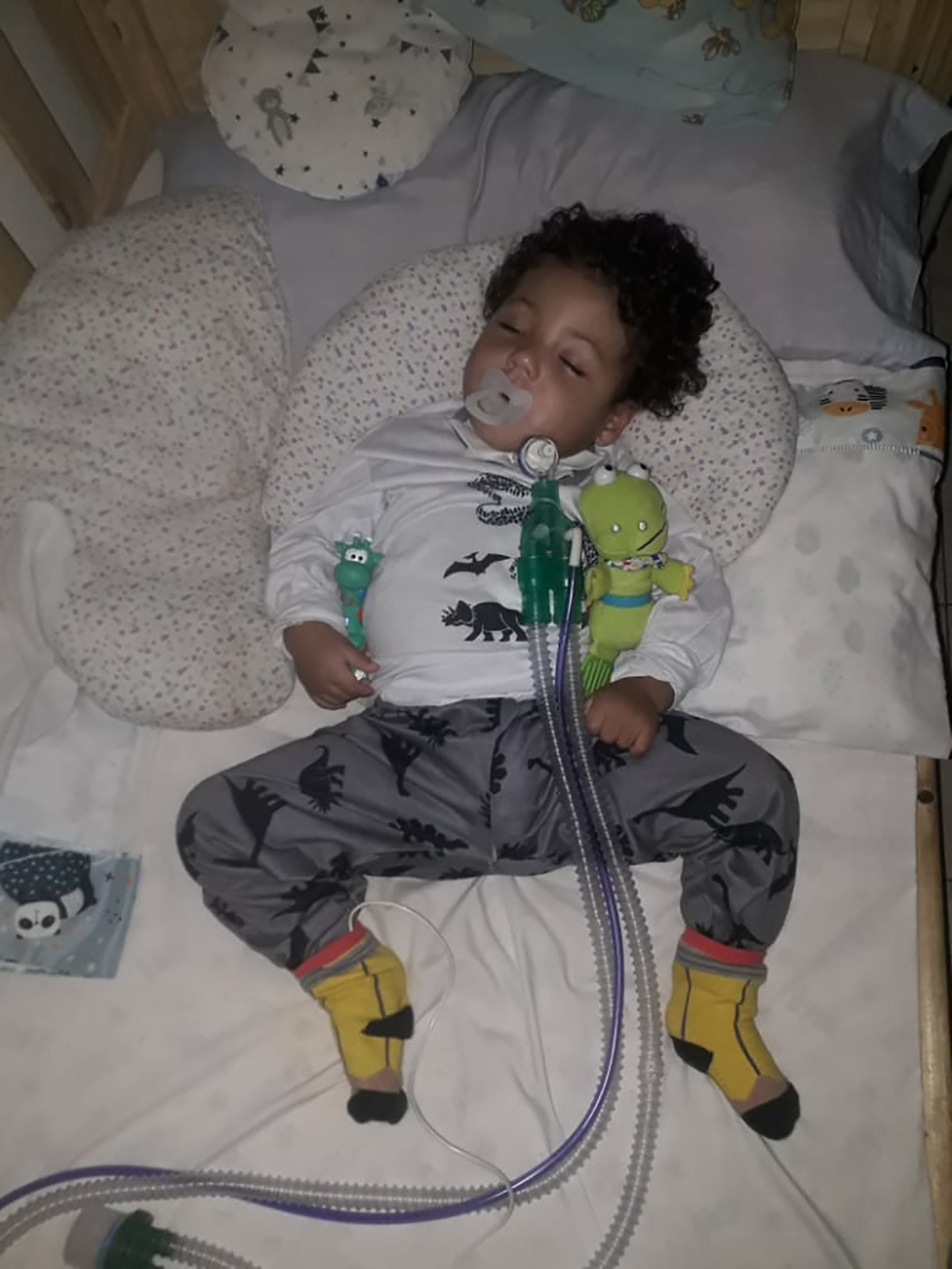El niño no puede estar sin asistencia respiratoria porque está traqueotomizado y durante la noche duerme asistido por el respirador (todosporerick)