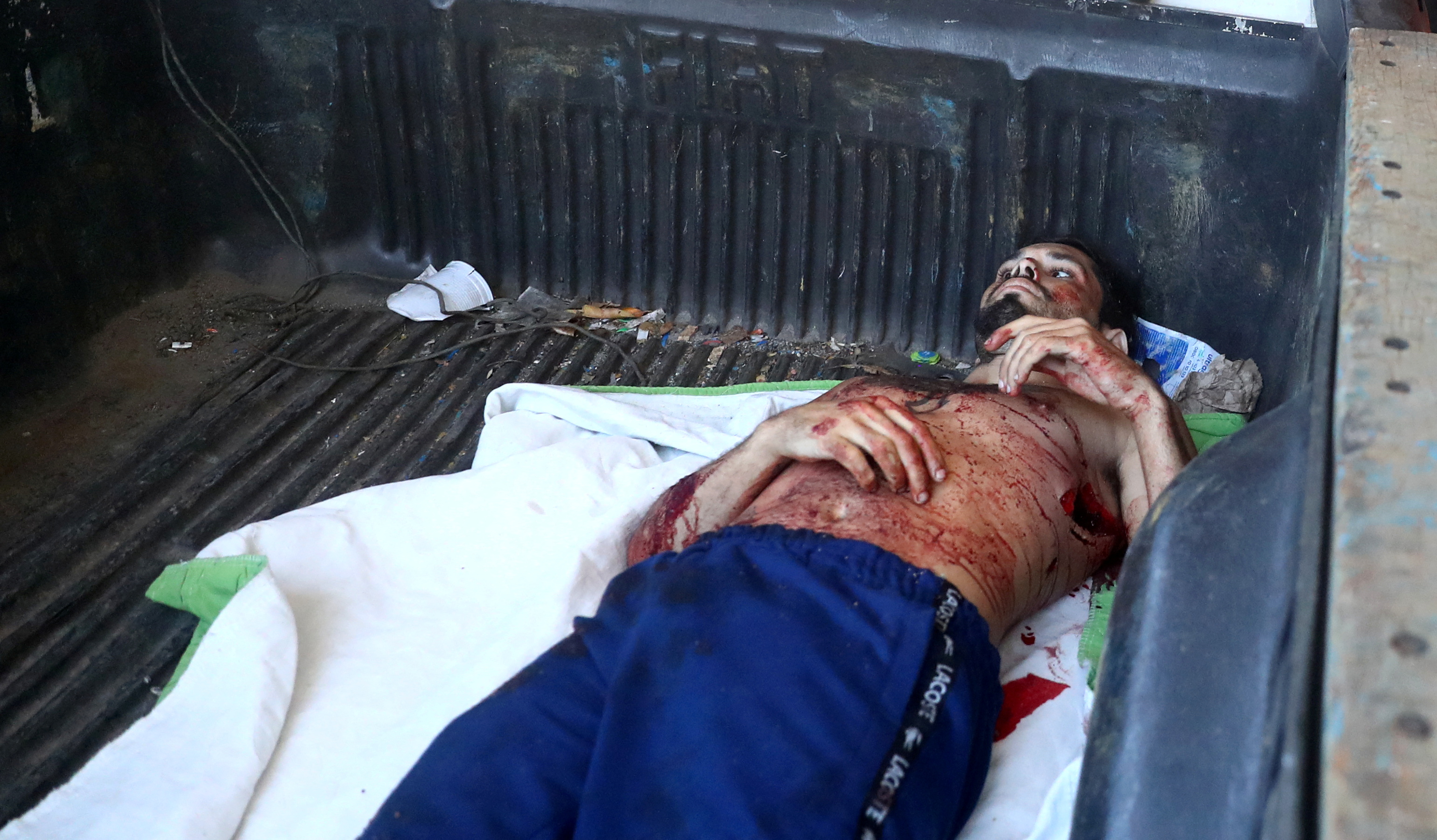 Un hombre herido trasladado al hospital Getulio Vargas de Río de Janeiro (REUTERS/Pilar Olivares)
