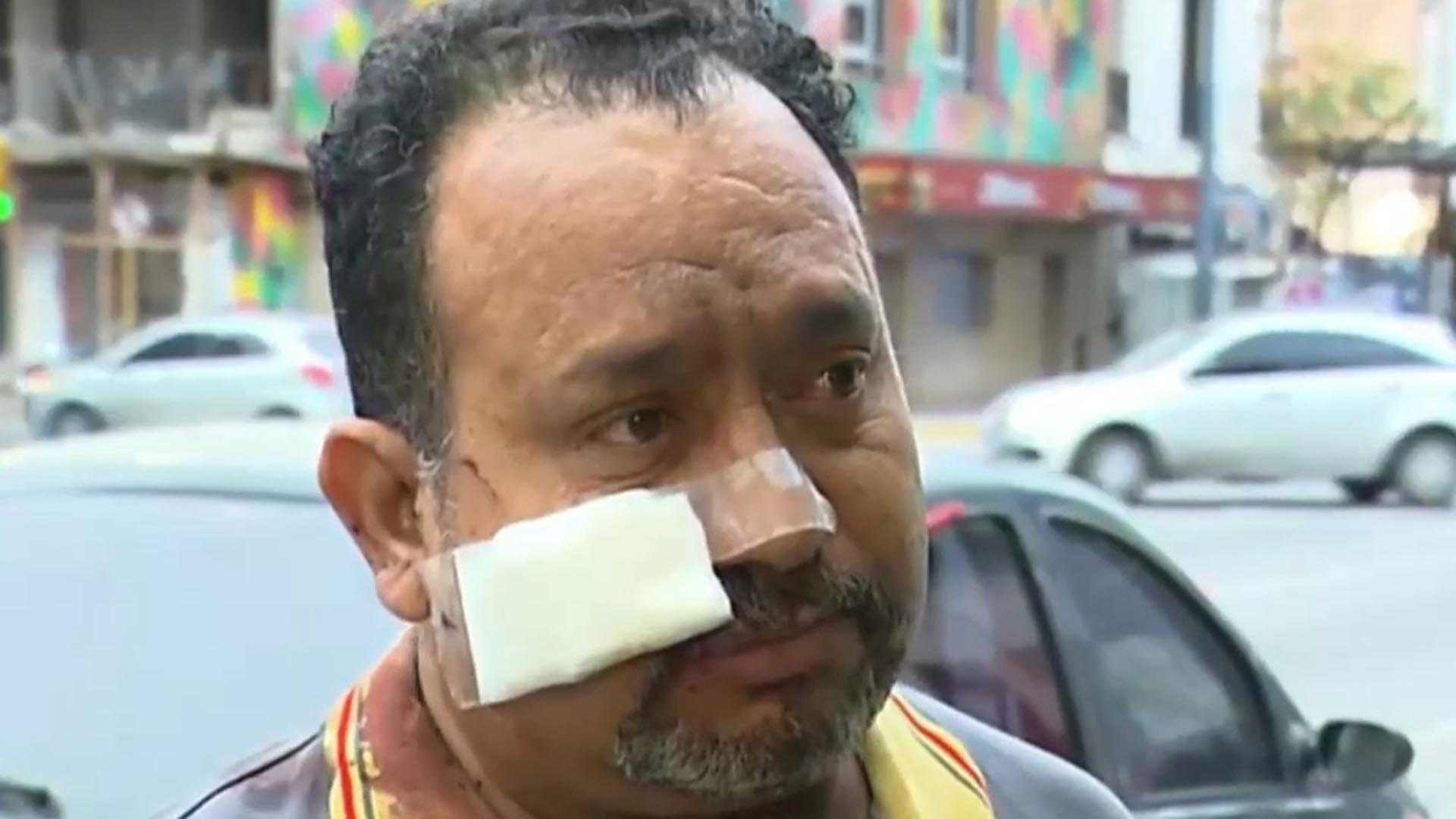 Brutal ataque a un taxista en Córdoba: simularon ser pasajeros y le desfiguraron la cara con una botella