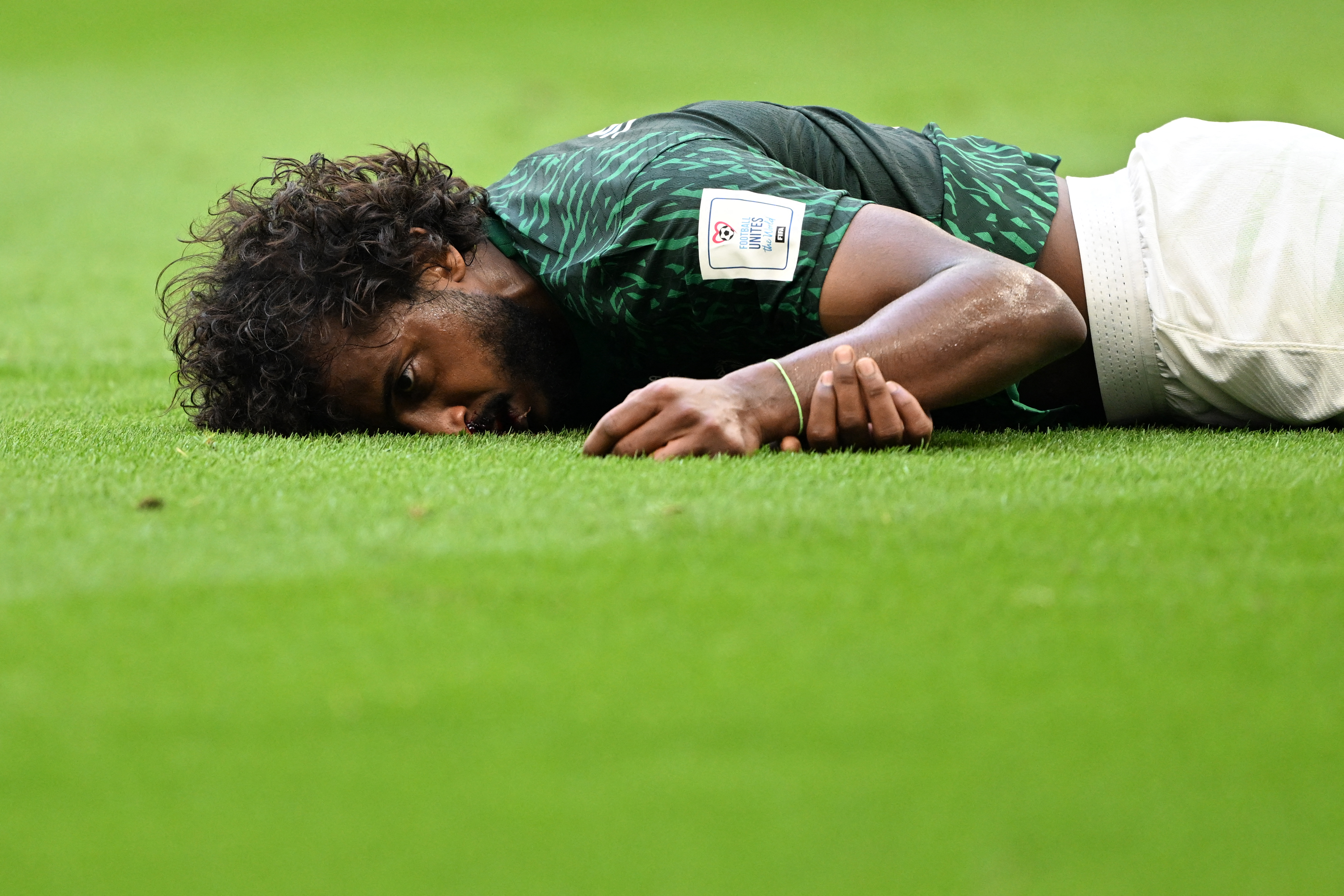 Yasser Al-Shahrani no pudo continuar con el partido. Foto: Kirill KUDRYAVTSEV / AFP