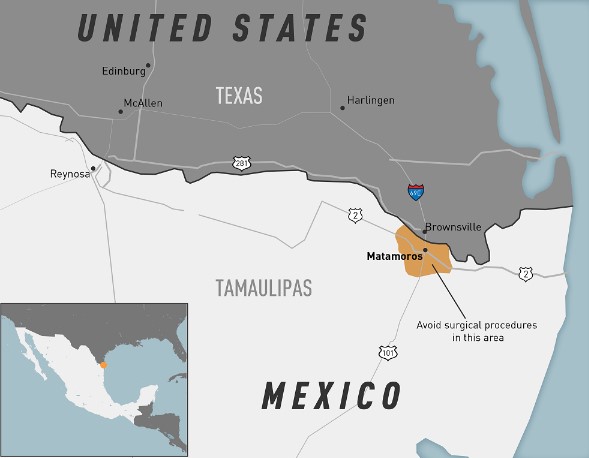 Los CDC emitieron una alerta tras detectar casos de meningitis fúngica en ciudadanos estadounidenses que viajaron Matamoros, Tamaulipas. Foto: cdc.gov