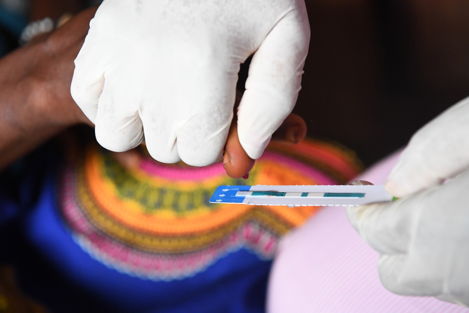 una de las formas para evitar la propagación del VIH es la profilaxis previa a la exposición (PrEP) (Foto: UNICEF/Europapress)