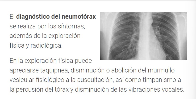 Como se puede ver en la imagen del CUN, la radiografía es muy parecida a la de Miguel Barbosa (Captura de pantalla)