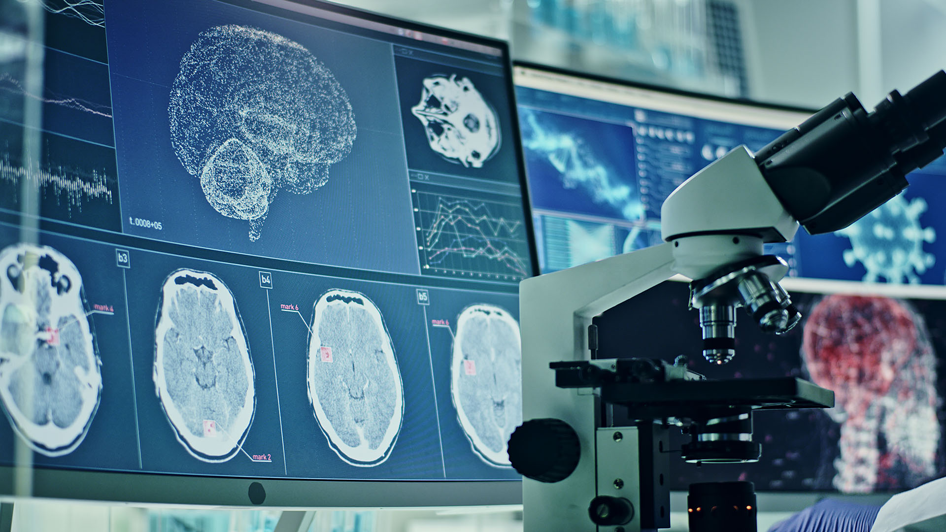 Des scientifiques de Harvard ont analysé des échantillons de tissus cérébraux de 21 patients décédés du COVID-19 (Getty)