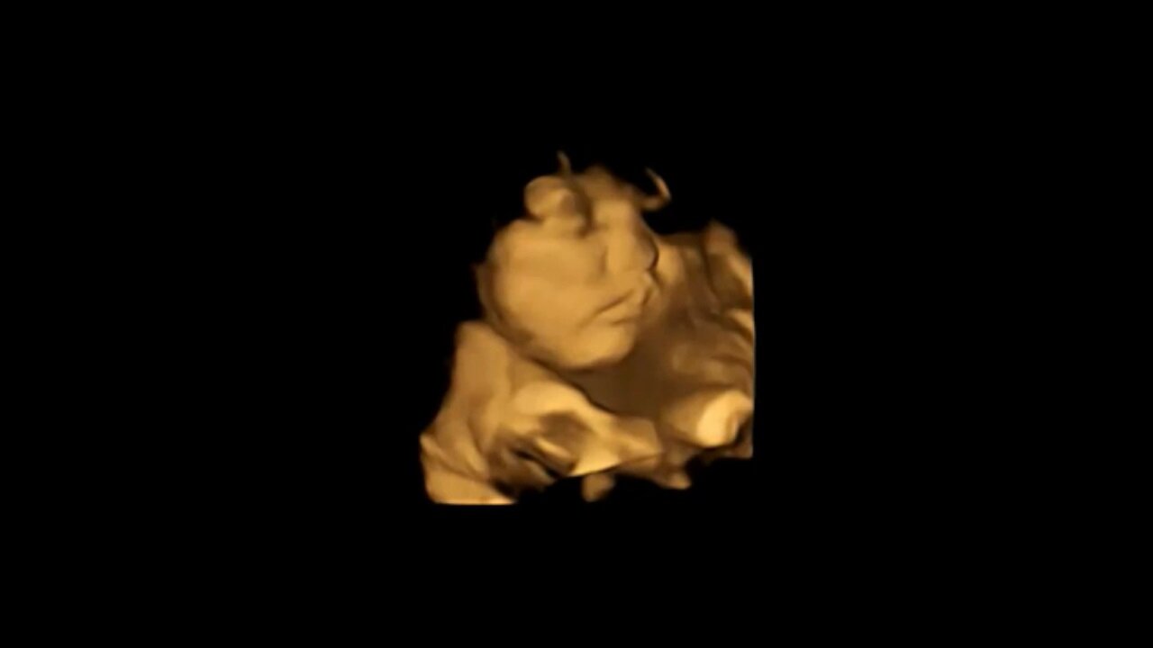 Una imagen de escaneo 4D de un feto que muestra una cara neutral ante la zanahoria / Crédito: Estudio FETAP (Preferencias de sabor fetal), Laboratorio de Investigación Fetal y Neonatal, Universidad de Durham