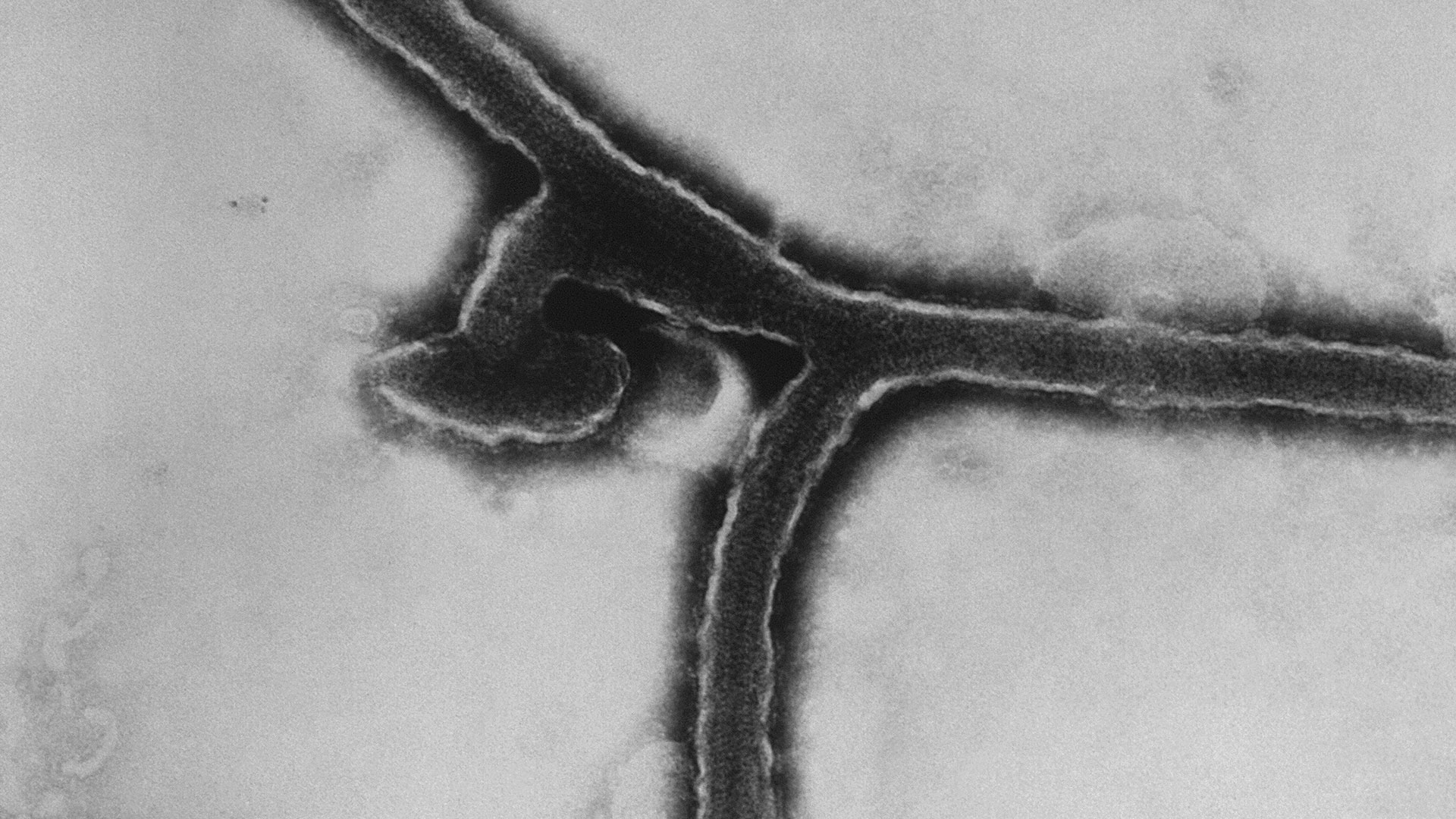 La enfermedad del virus de Marburgo es generada por el virus transmitido por animales de la misma familia Filoviridae del virus del Ébola. (Photo by Smith Collection/Gado/Getty Images).