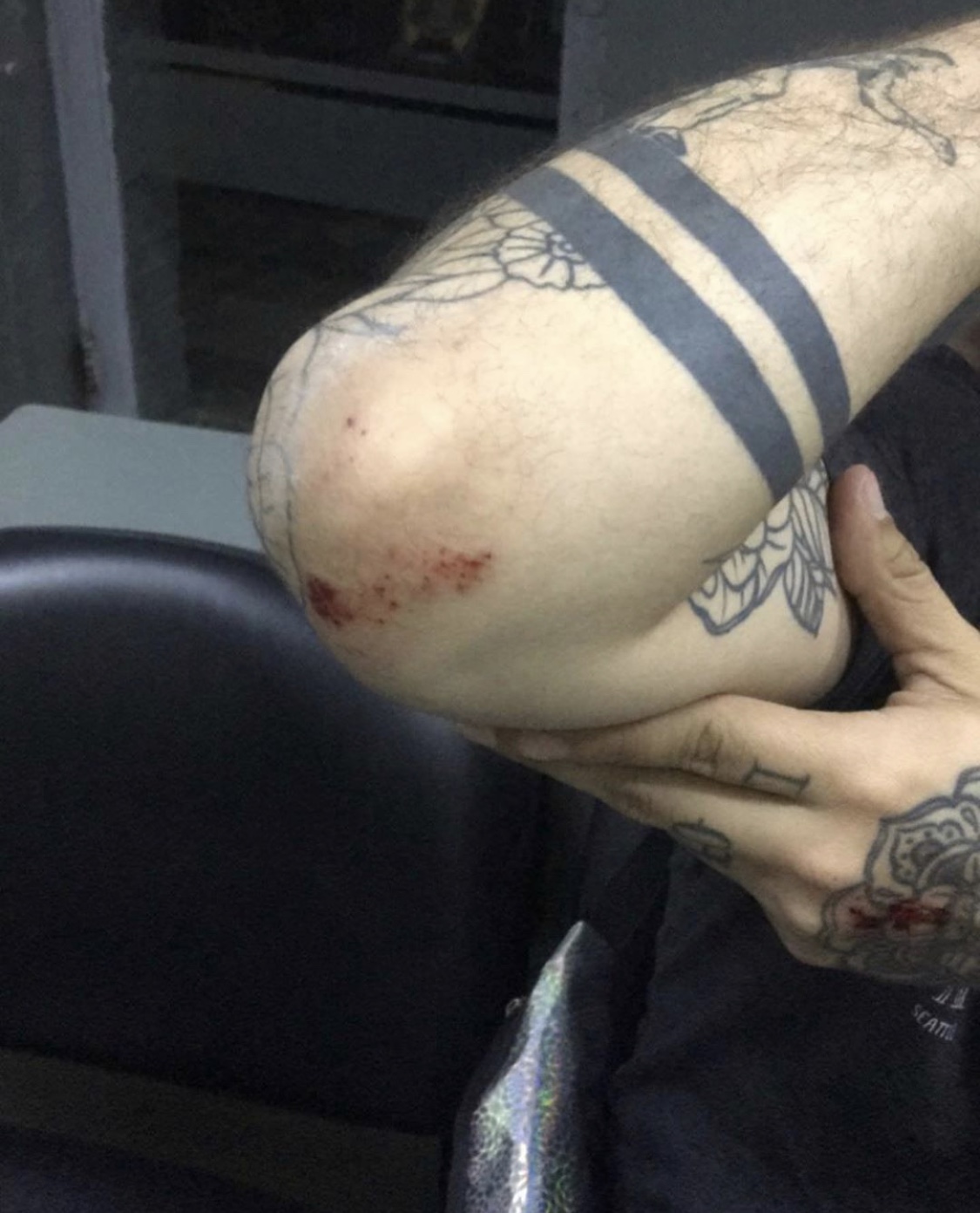 Cristian Jacobsen subió un video a Instagram mostrando las heridas del ataque.