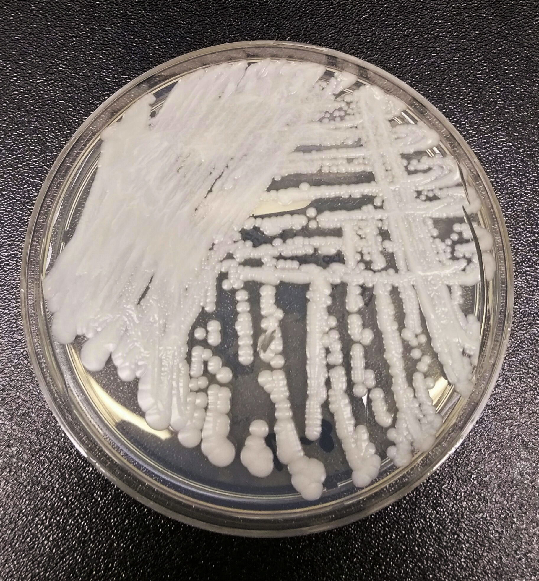 En algunas personas, si se produce un desequilibrio, los hongos del género Candida pueden causar peligrosas infecciones sistémicas.
(Shawn Lockhart/Centros para el Control y la Prevención de Enfermedades de Estados Unidos vía AP, Archivo)