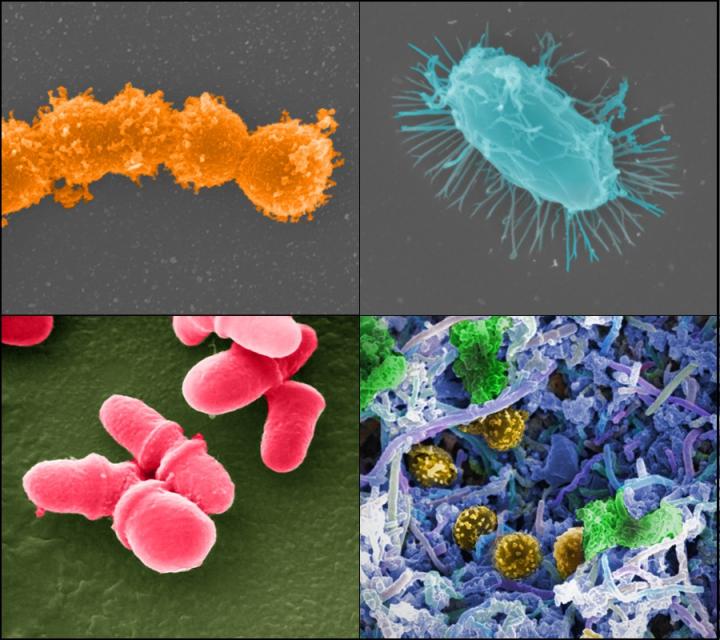 Encontaron que bacterias resistentes a los antibióticos encontradas en el intestino habían migrado al torrente sanguíneo en el 20% de los pacientes con COVID-19/ Jonathan Bailey, NHGRI/Archivo