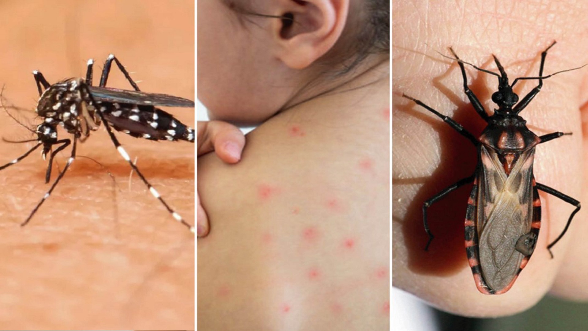 México Sumó Más De 200 Casos De La Enfermedad De Chagas Qué Es Y Cómo Se Contagia Infobae 2845