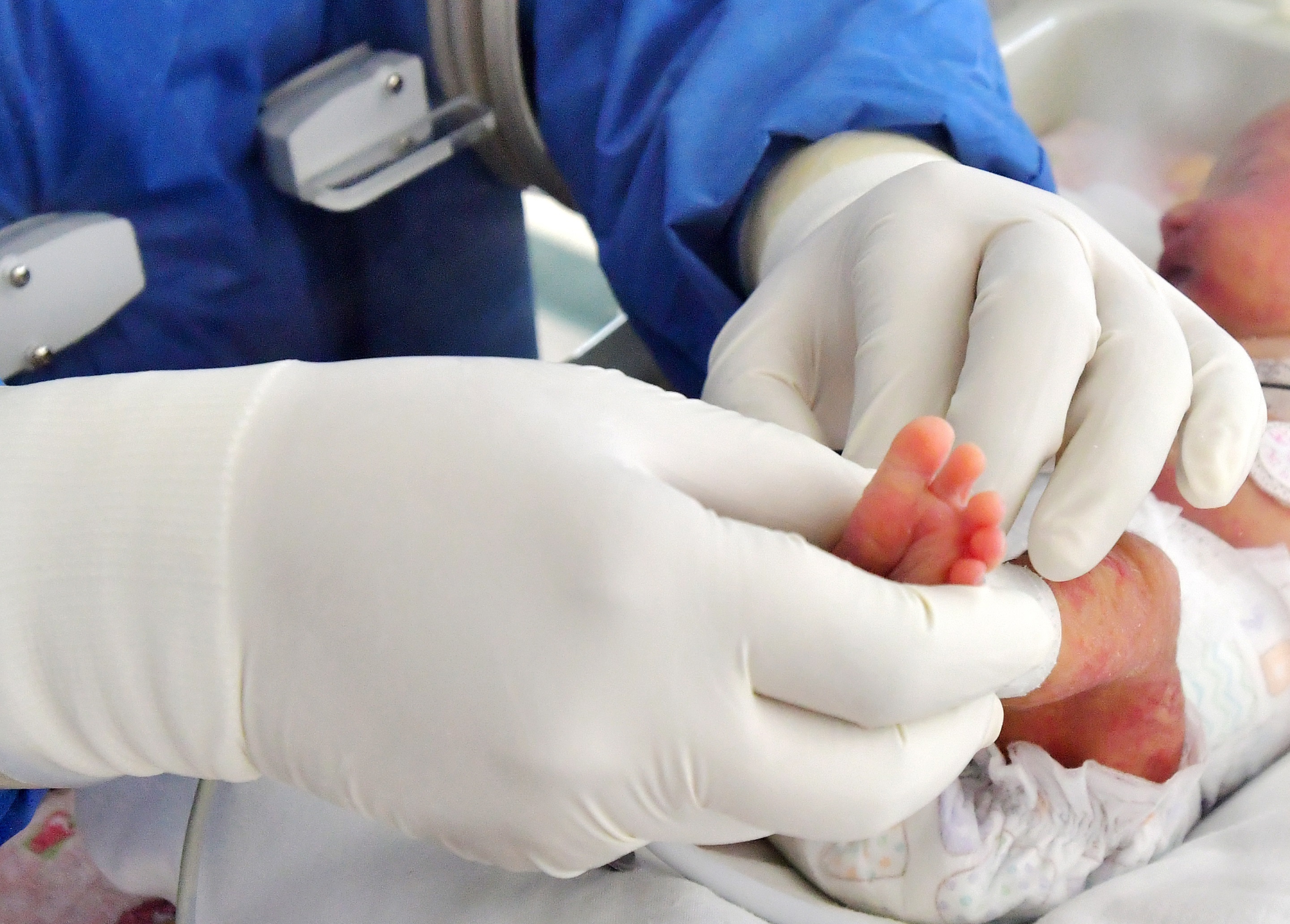 “Más de 40 enfermedades congénitas″: instan a ampliar la pesquisa neonatal