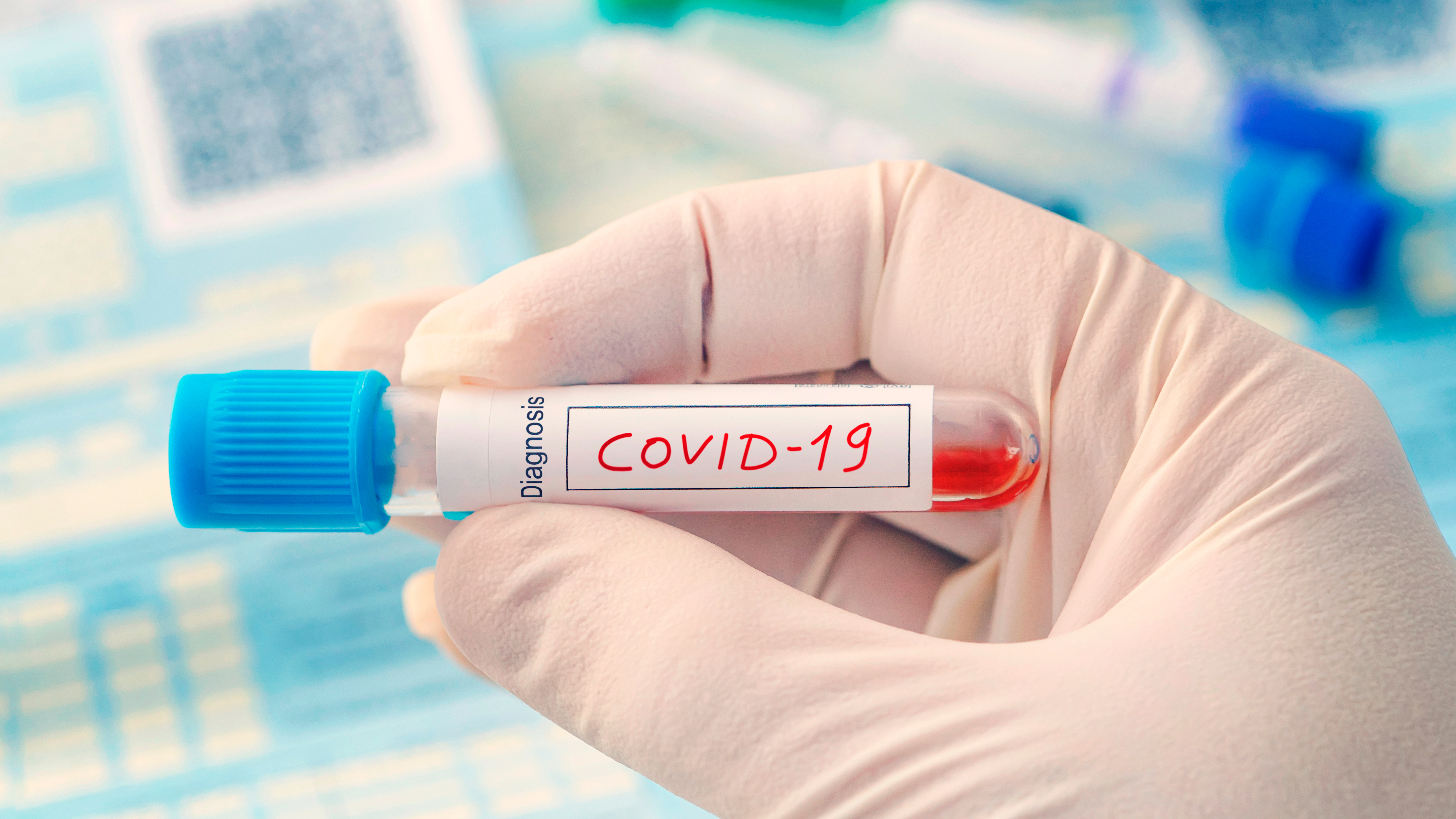 En el mundo existe una gran carrera por parte de la comunidad científica para lograr una vacuna y dar con el tratamiento más eficaz para el coronavirus COVID-19 (Shutterstock)