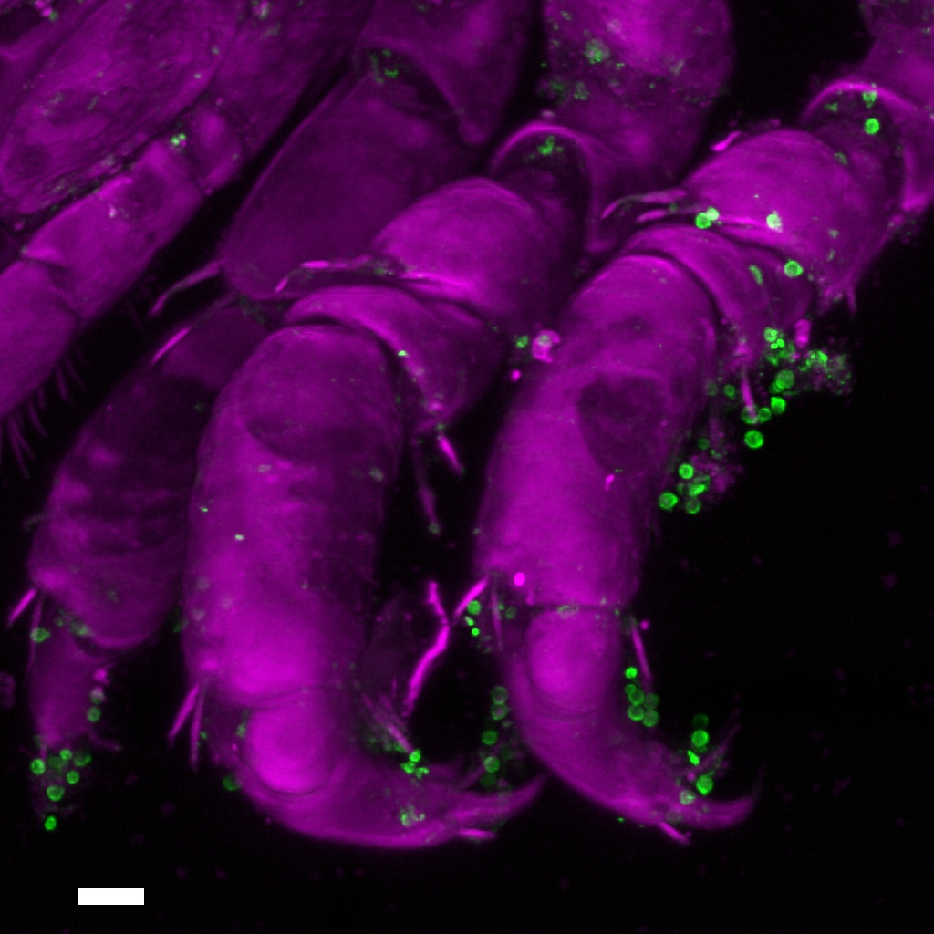 Las gametas masculinas del alga roja son transportadas adheridas en las patas del crustáceo (Sebastien Colin; Max Planck Institute for Biology, Tübingen, Germany; Station Biologique de Roscoff, CNRS, SU, Roscoff, France)