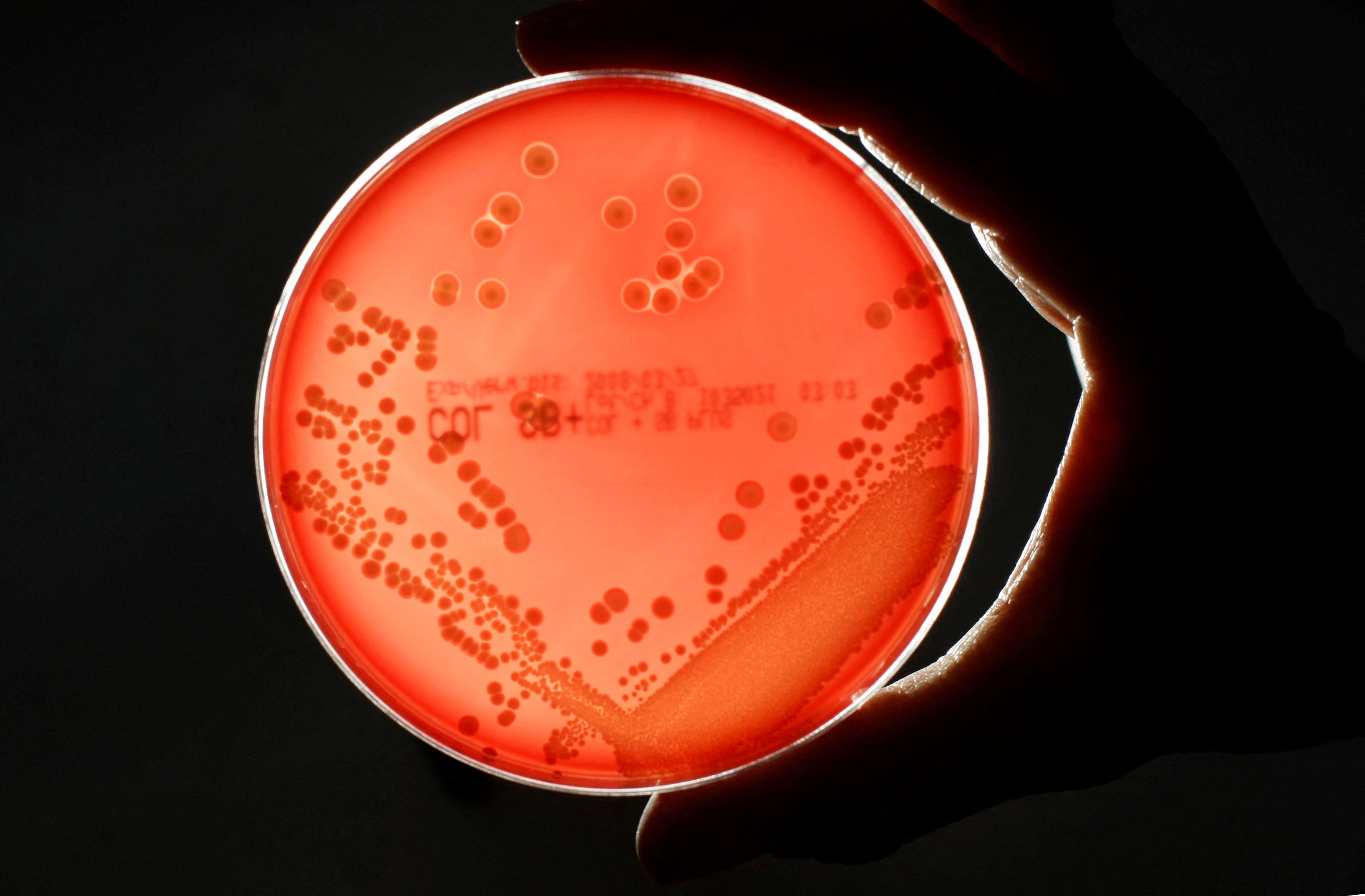 Para el trabajo, el grupo analizó 3.096 muestras de microbioma intestinal de personas en 14 países diferentes (Reuters) 