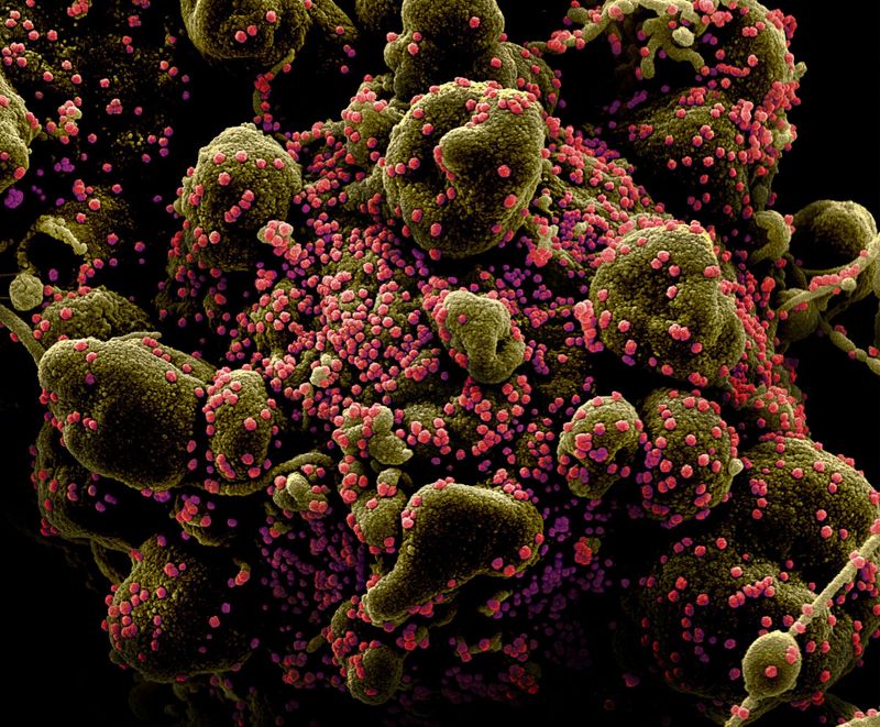 Micrografía electrónica de barrido coloreada de una célula apoptótica (marrón verdoso) muy infectada con partículas del virus SARS-COV-2 (rosa)  (NIH/Handout via REUTERS)