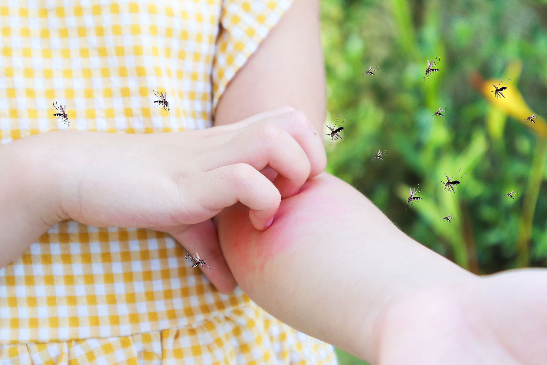 Siete consejos de pediatras para proteger a bebés, niños y adolescentes del dengue