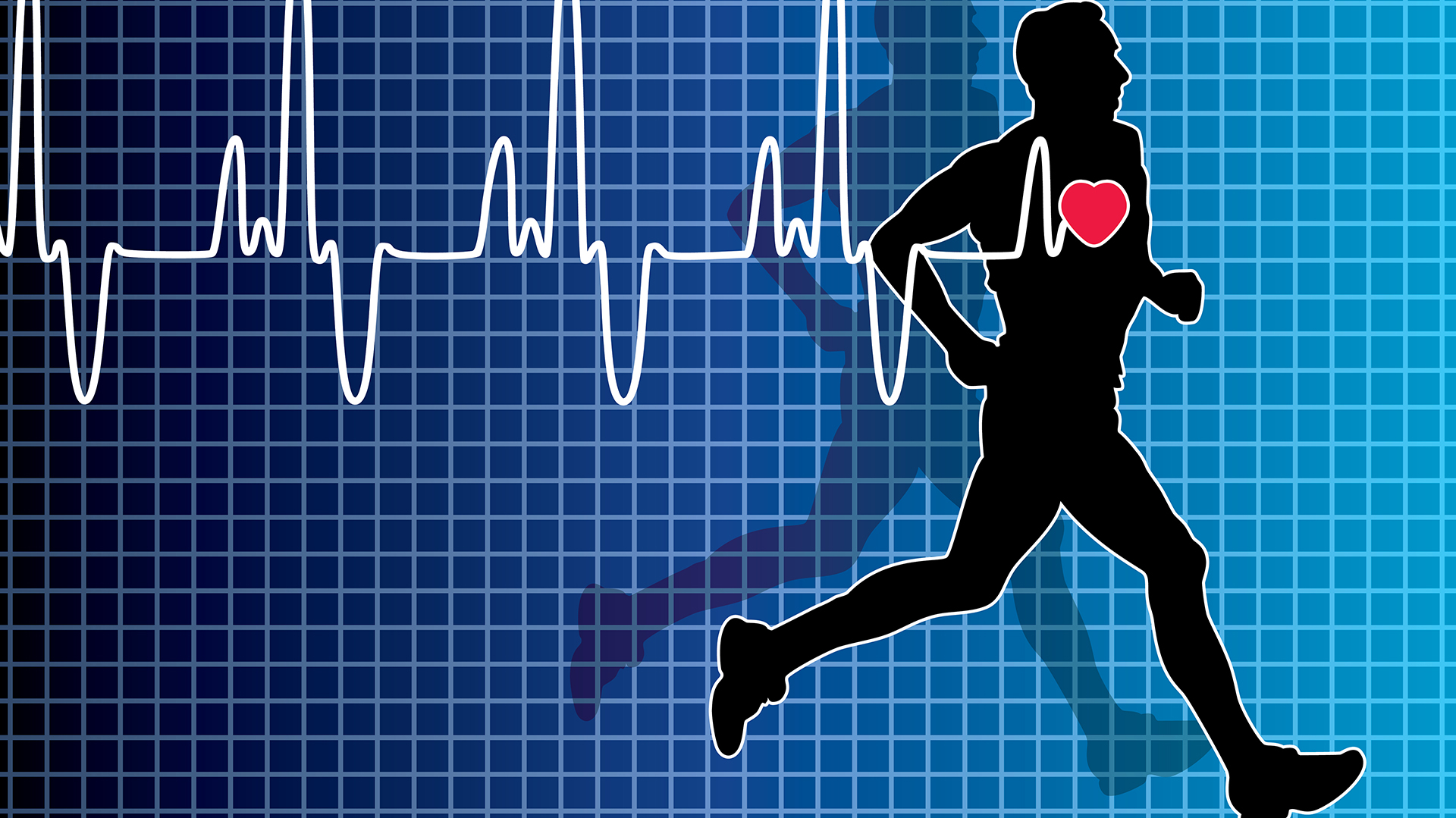 La actividad física es fundamental en el marco de una vida saludable para prevenir un ACV. La OMS recomienda 30 minutos de actividad física diaria o 150 minutos semanales (Istock)