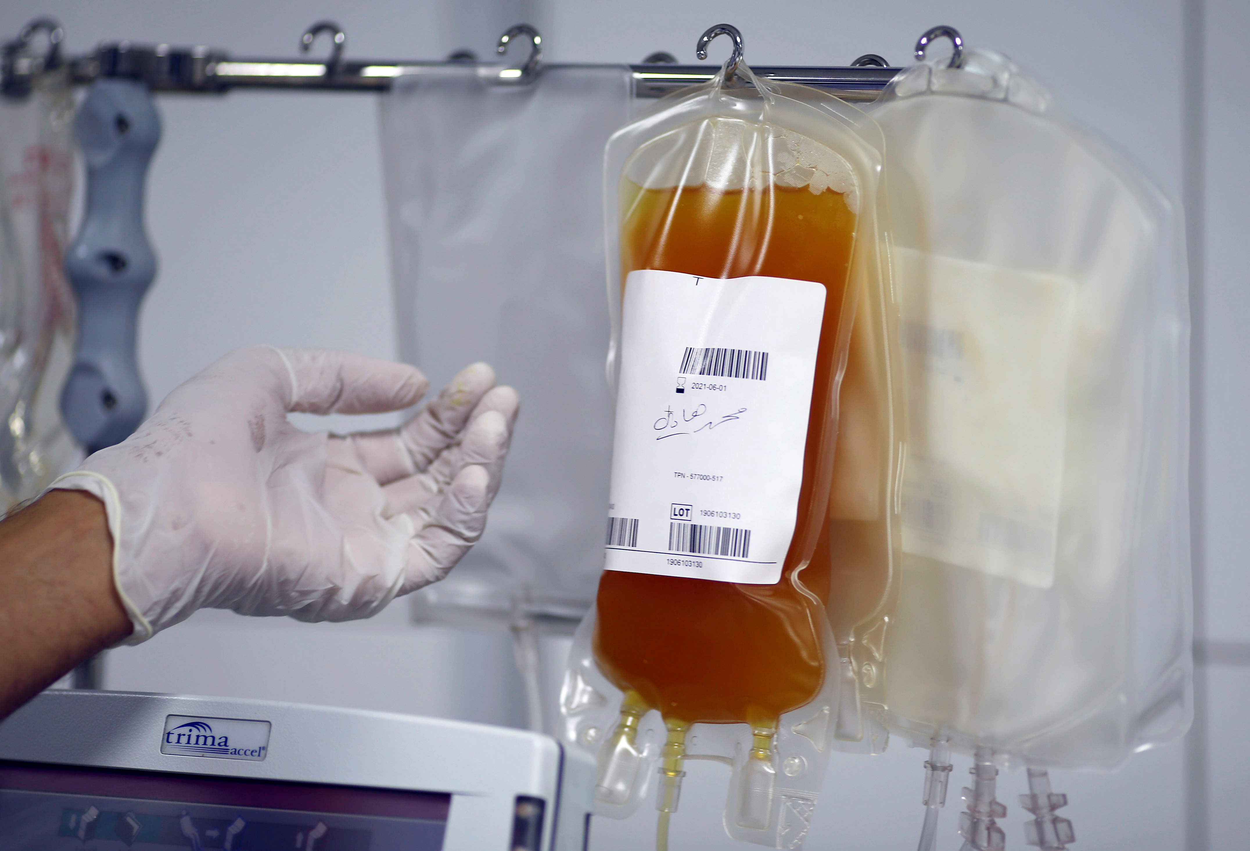 El plasma es un componente de la sangre, es transparente y algo amarillento. (REUTERS/Thaier Al-Sudani)